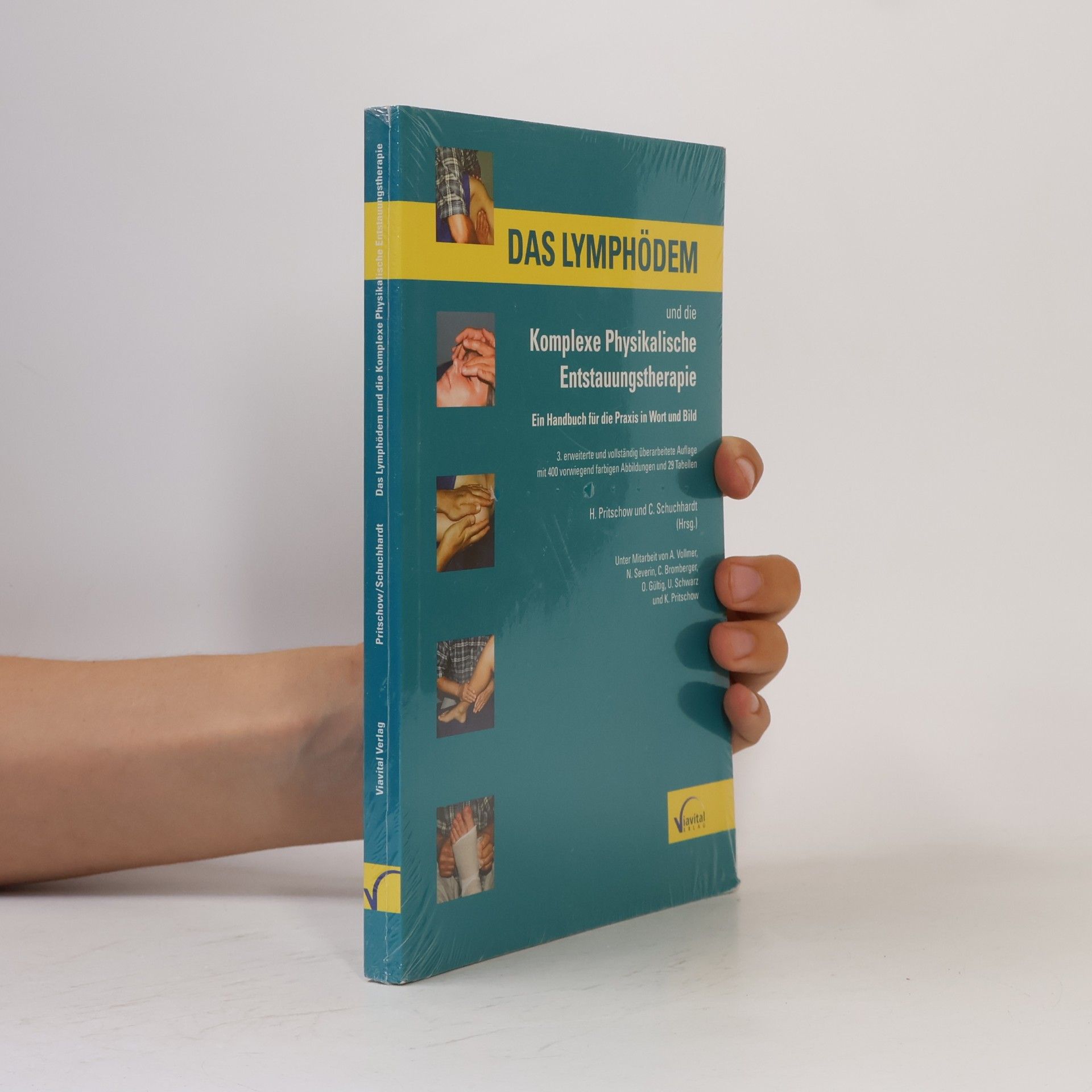 Hans Pritschow Das Lymphödem und die komplexe physikalische Entstauungstherapie