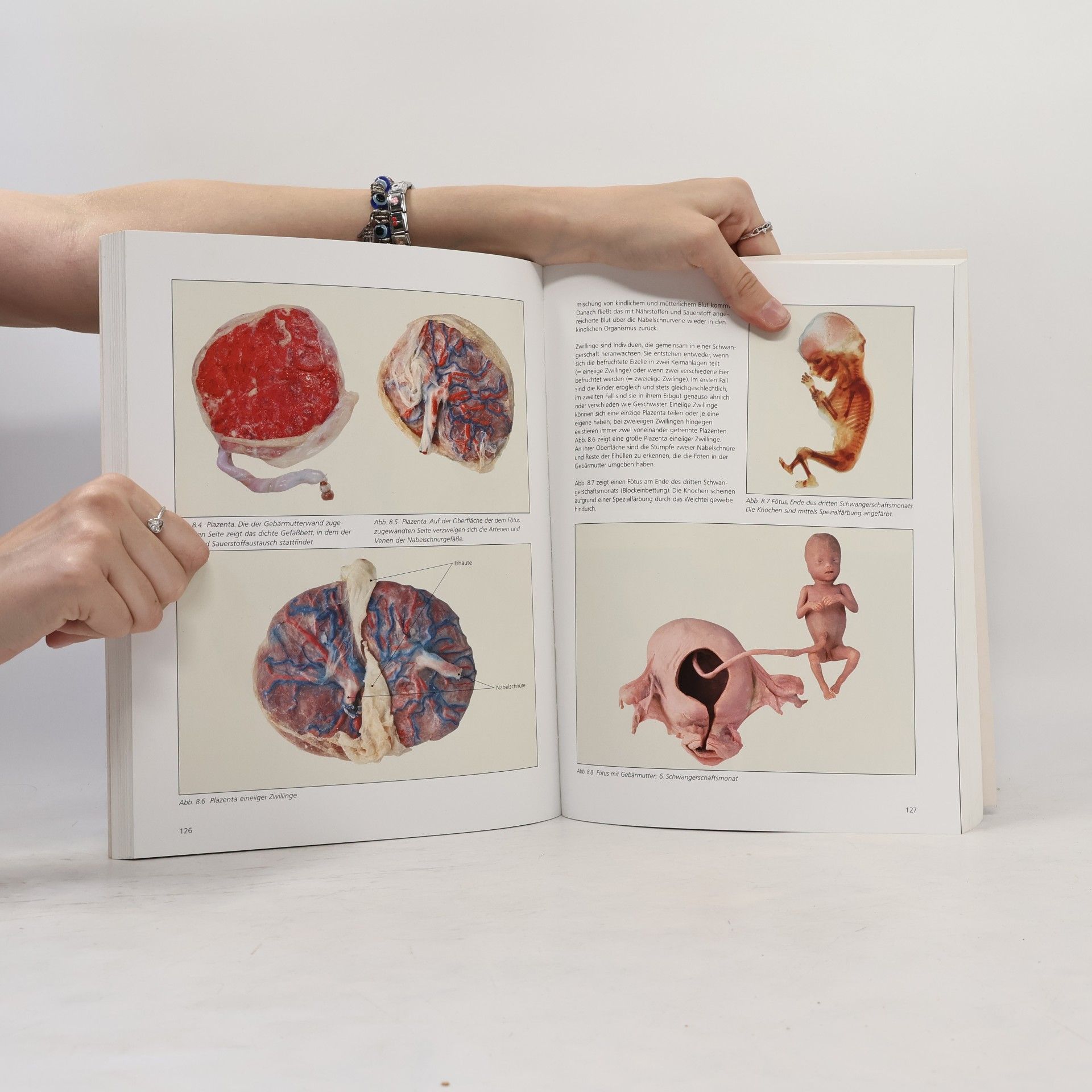 Guther von Hagens Körperwelten. Die Faszination des Echten