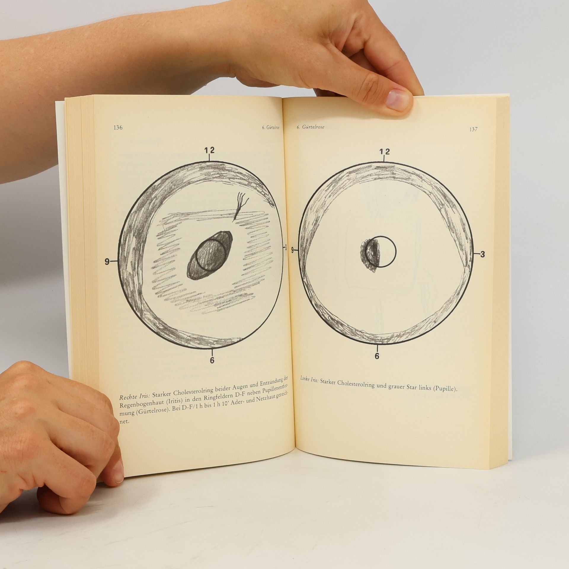 Hans Hommel Irisdiagnose