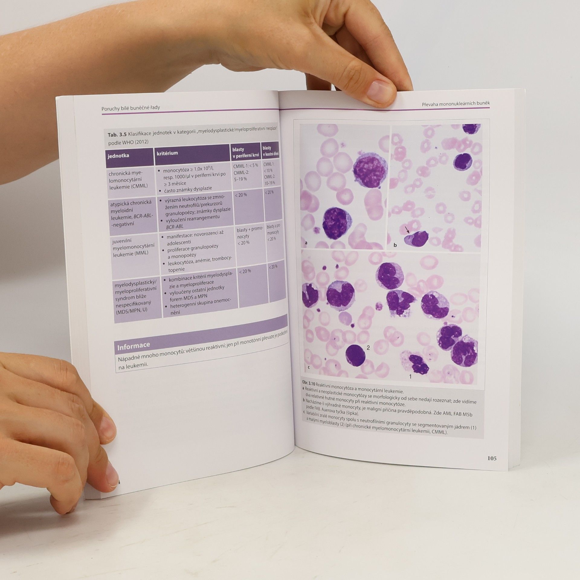 Torsten Haferlach Kapesní atlas hematologie