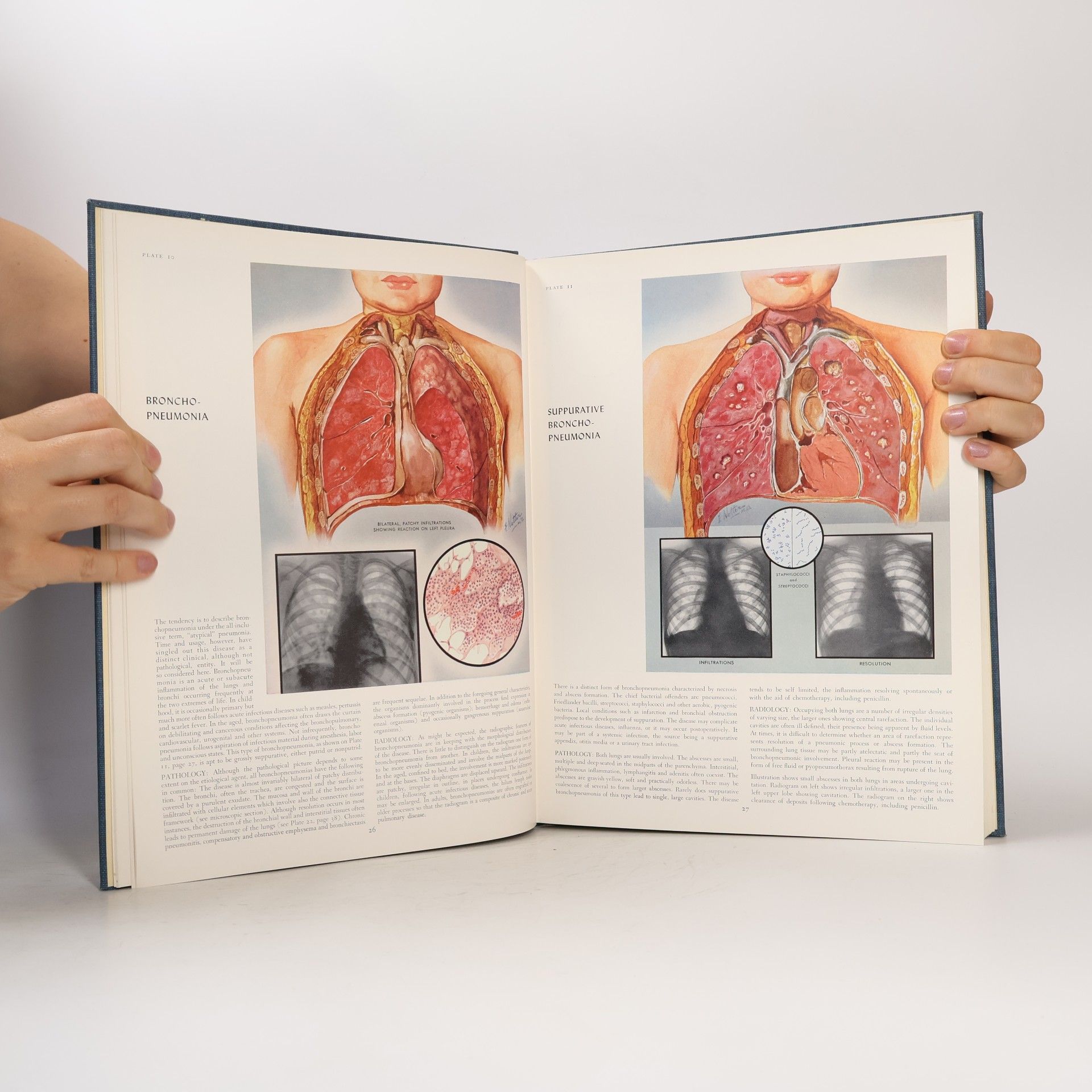 Frank Netter The Ciba Collection of Medical Illustrations