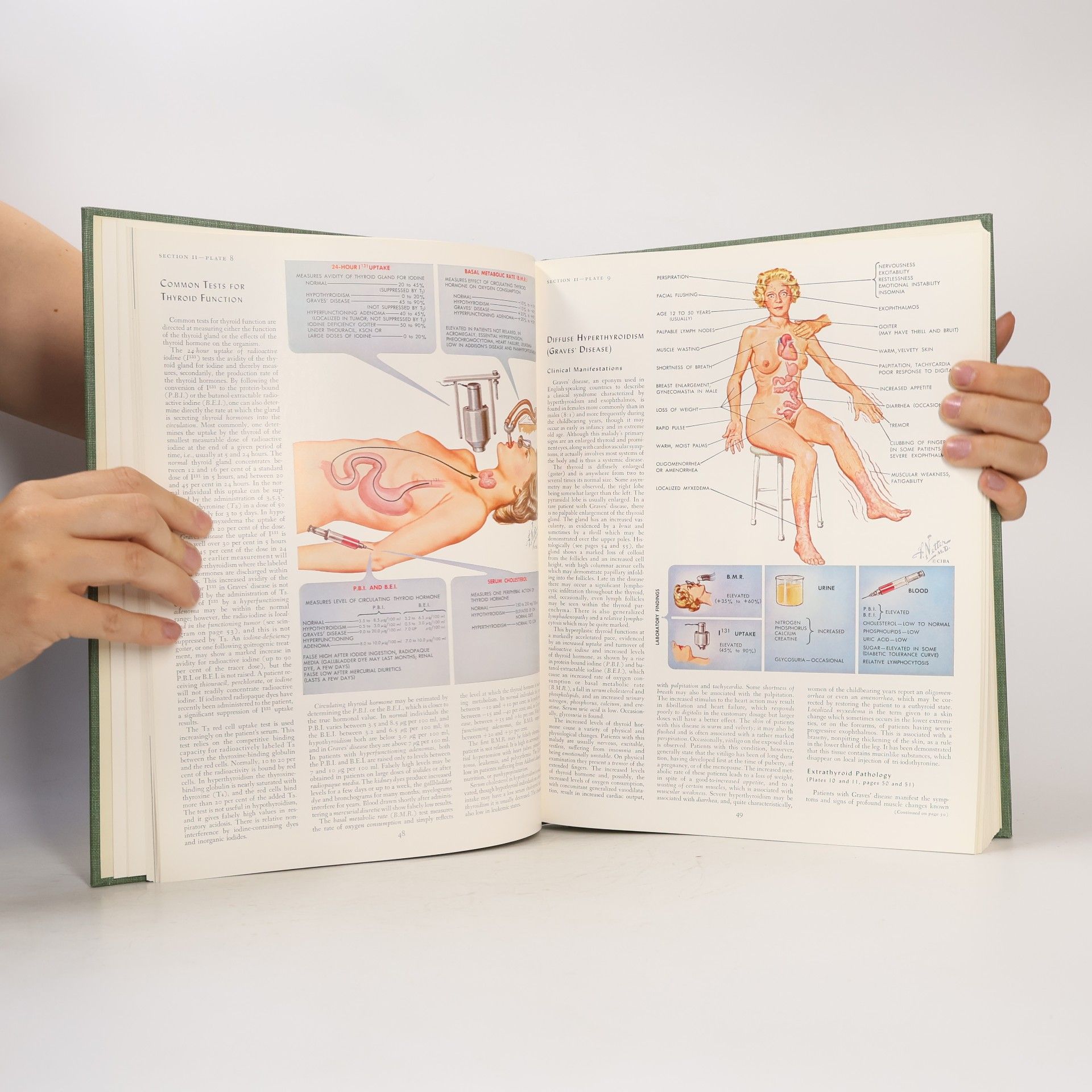 Frank H. Netter The Ciba Collection of Medical Illustrations. Volume 4. Endocrine System and Selected Metabolic Diseases
