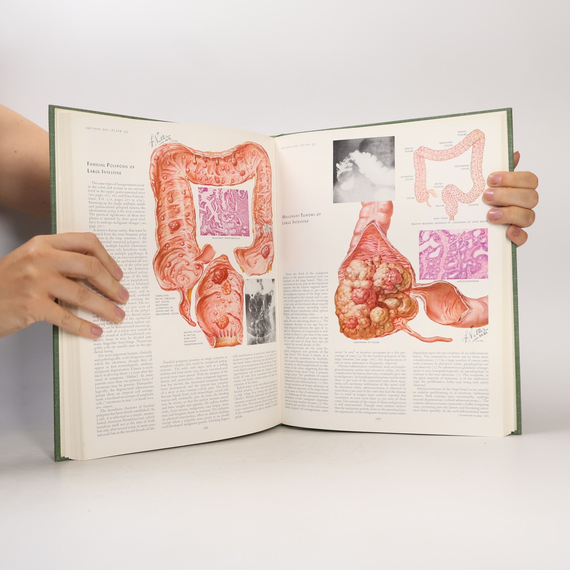 Frank Netter Digestive System 3