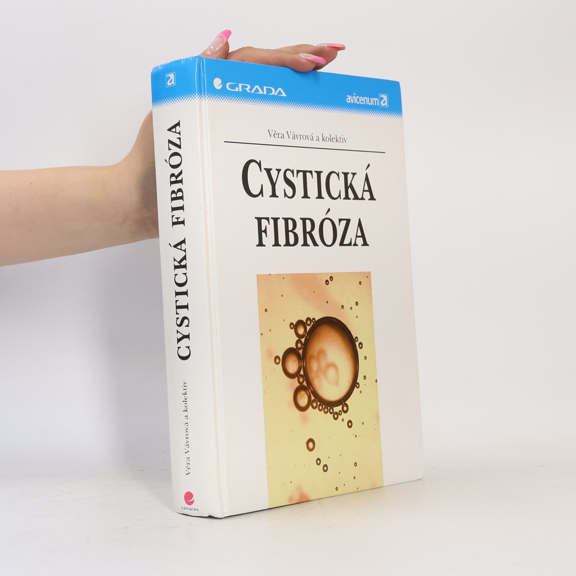 Věra Vávrová Cystická fibróza