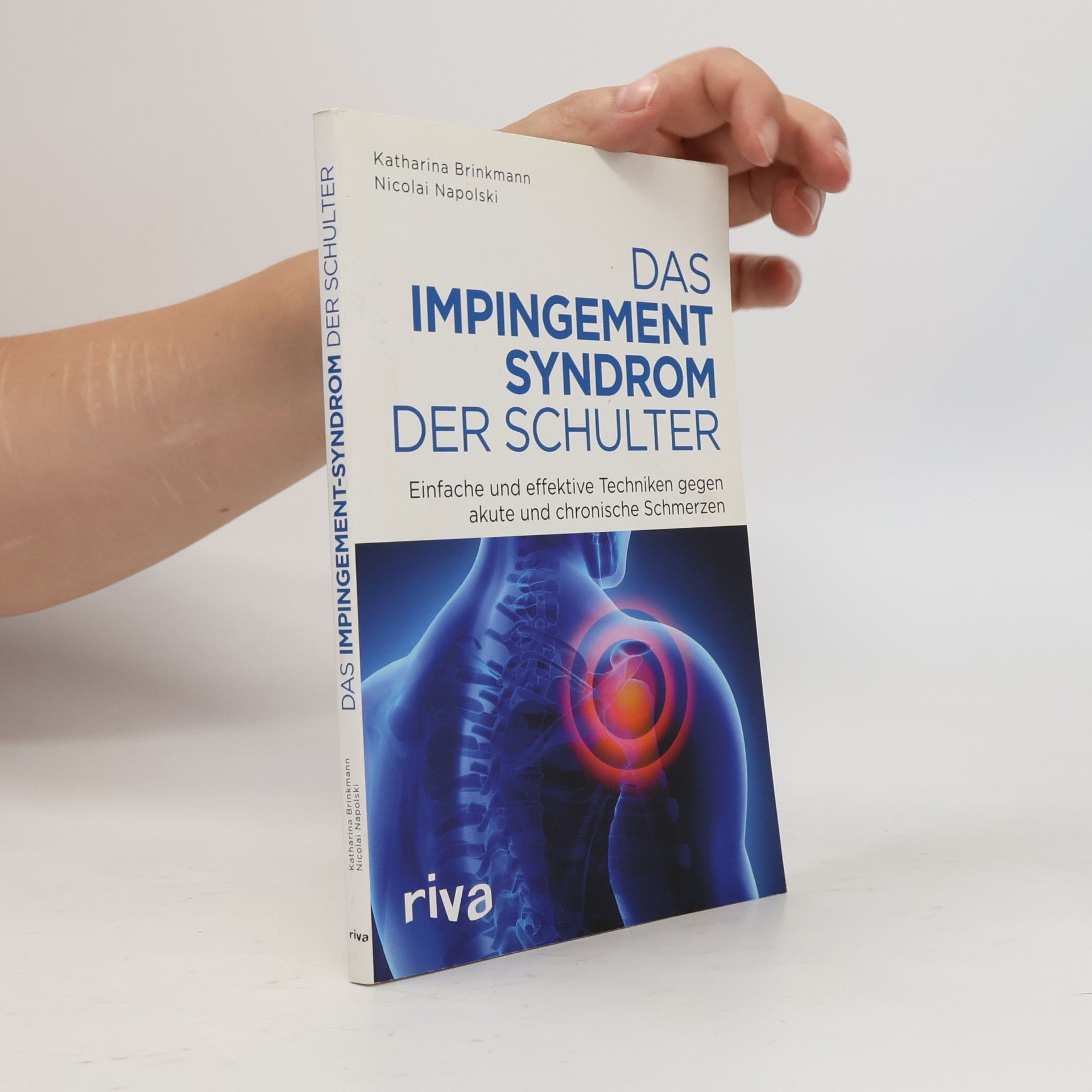 Das Impingement-Syndrom der Schulter