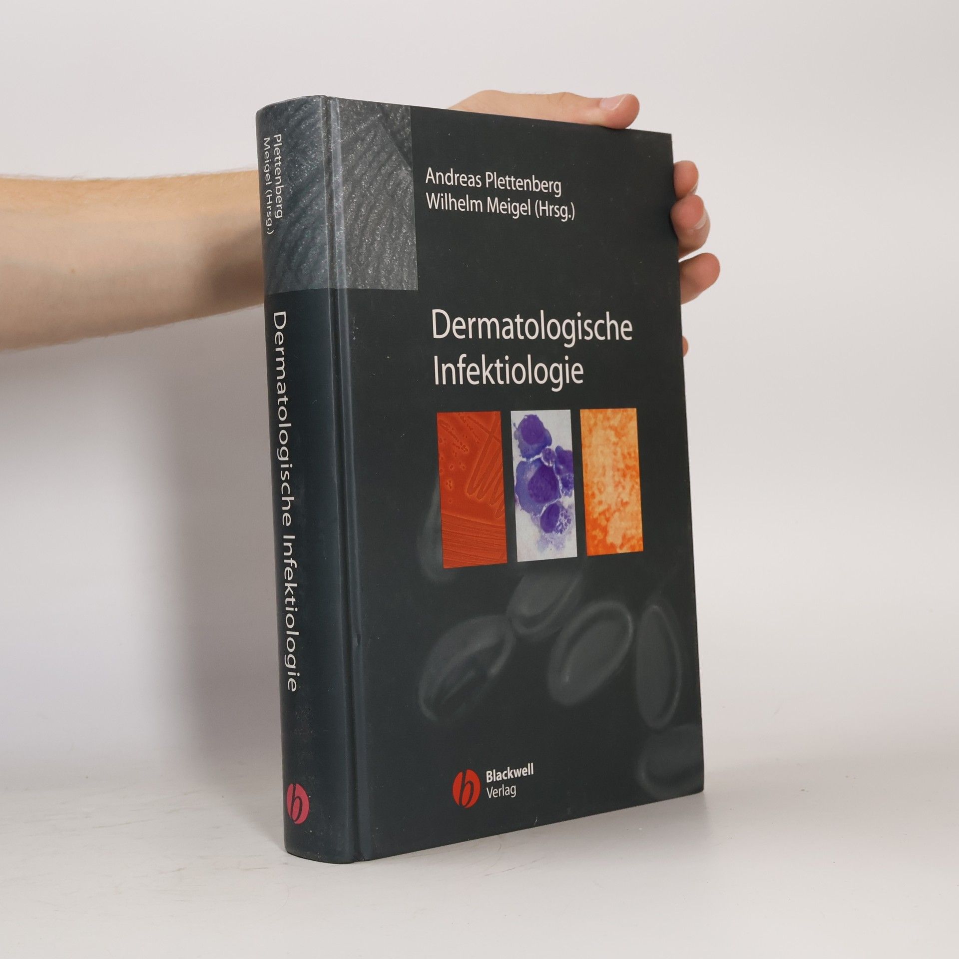 Dermatologische Infektiologie