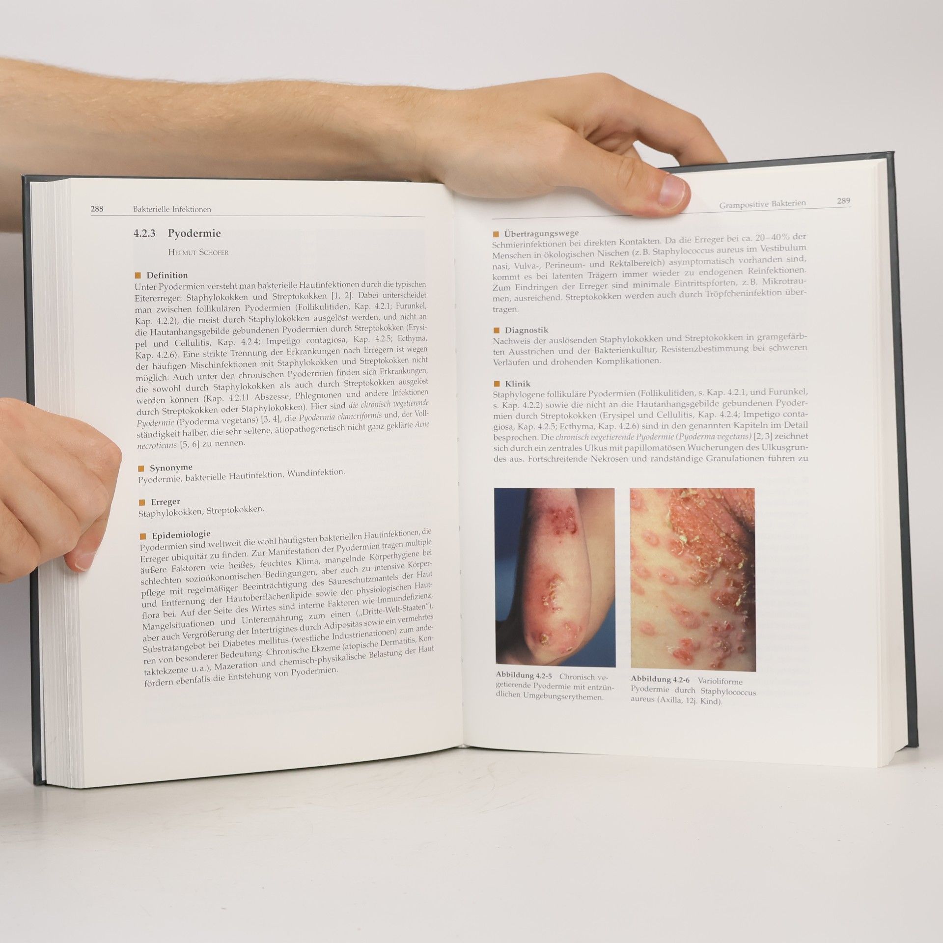 Andreas Plettenberg Dermatologische Infektiologie