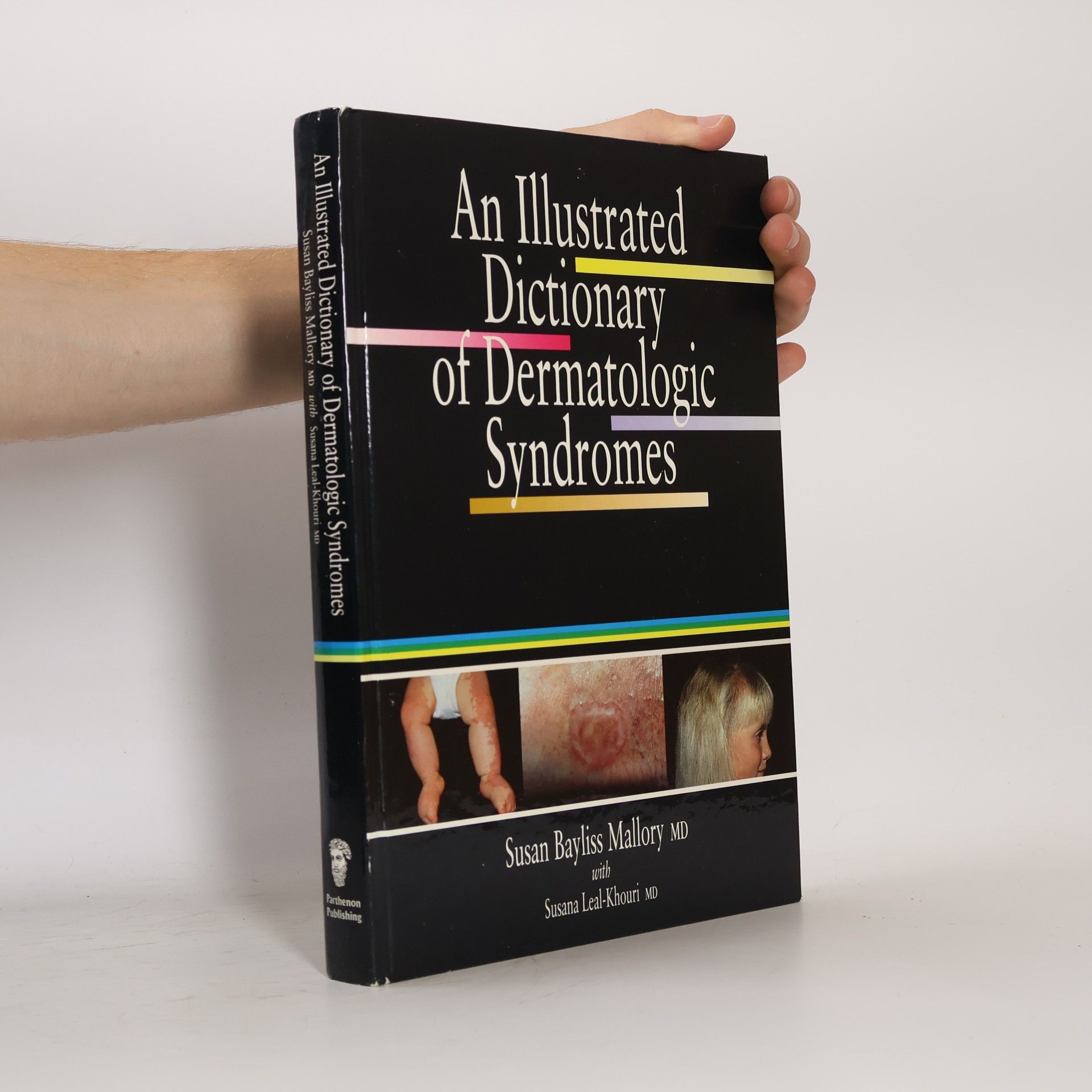 An Illustrated Dictionary of Dermatologic Syndromes