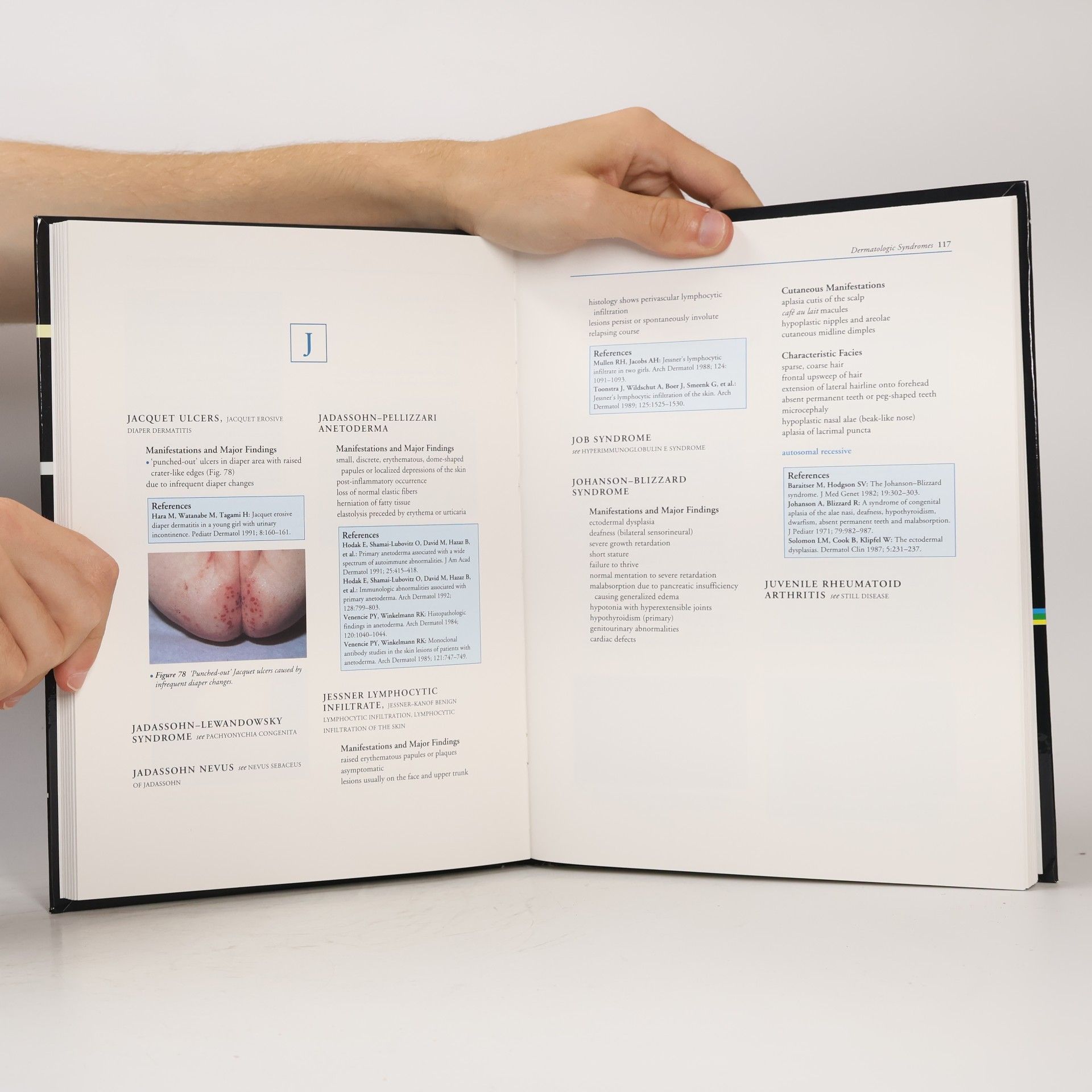 Susan Bayliss Mallory An Illustrated Dictionary of Dermatologic Syndromes