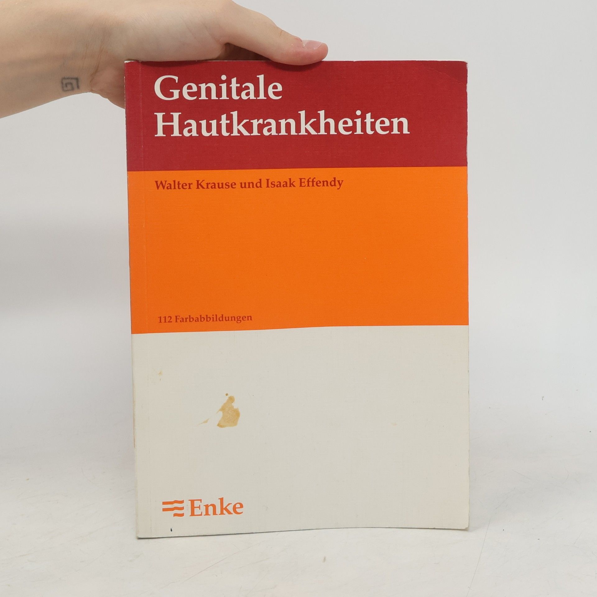 Walter Krause Genitale Hautkrankheiten
