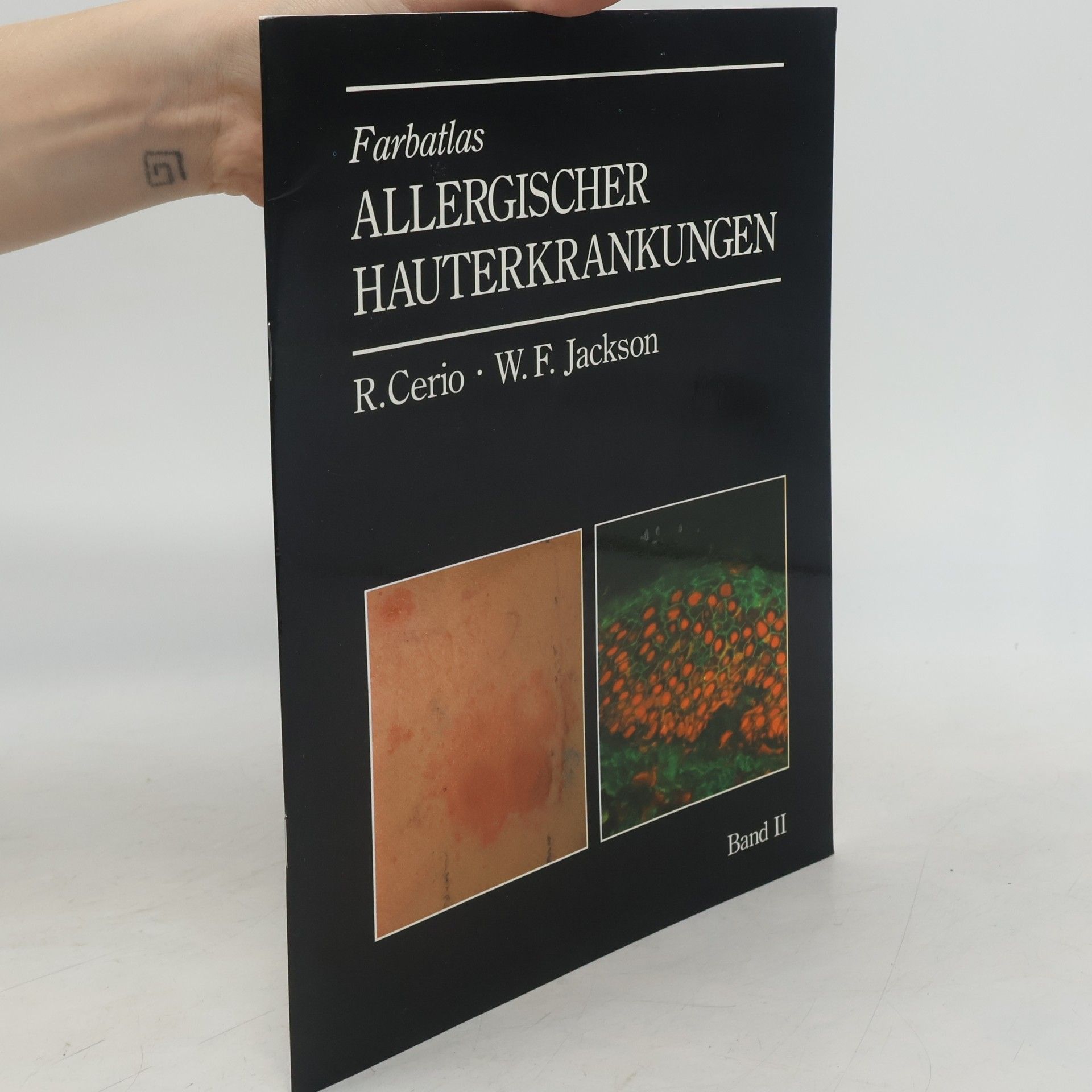 Farbatlas. Allergischer Hauterkrankungen. Band II.