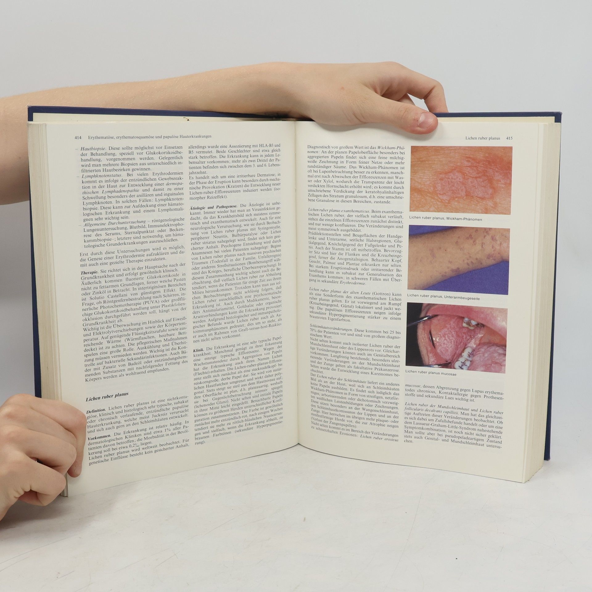 Otto Braun-Falco Dermatologie und Venerologie