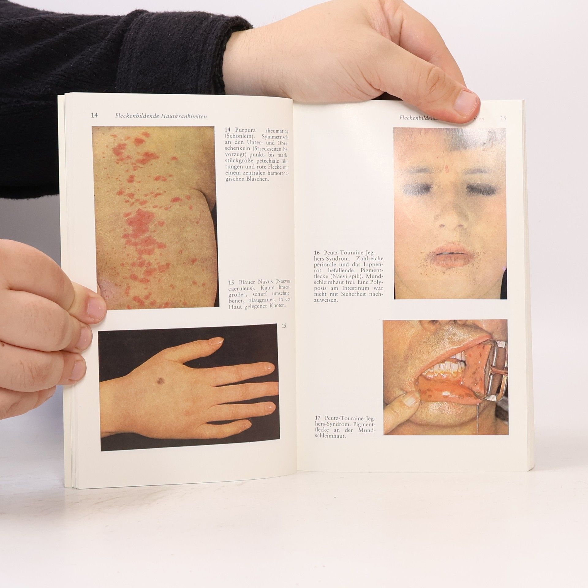 Joseph Kimmig Taschenatlas der Haut- und Geschlechtskrankheiten