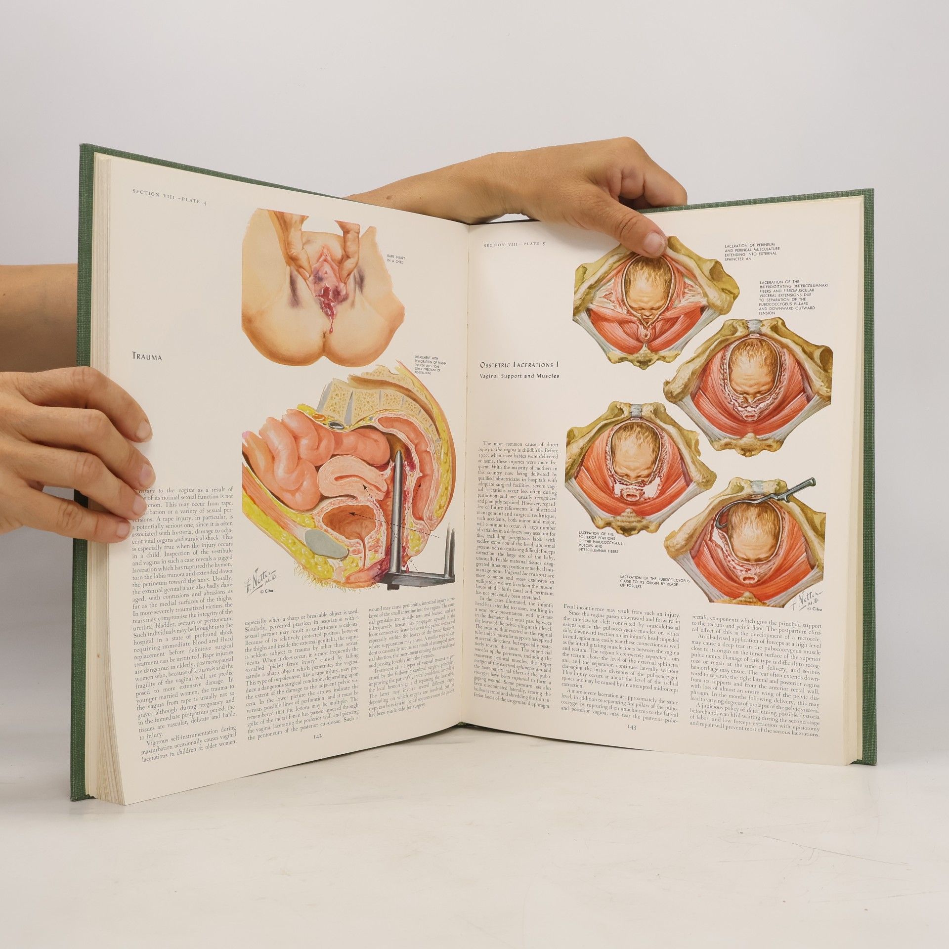 Frank H. Netter The Ciba Collection of Medical Illustrations