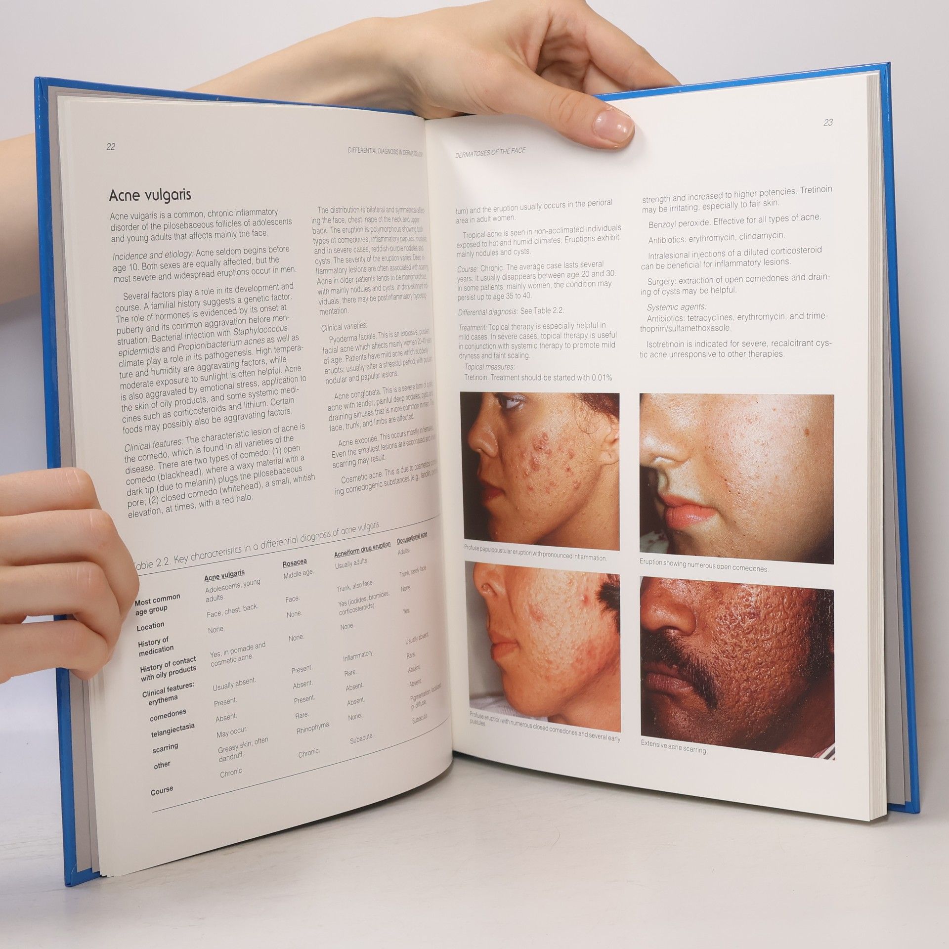 Richard C. Gibbs Differential Diagnosis in Dermatology