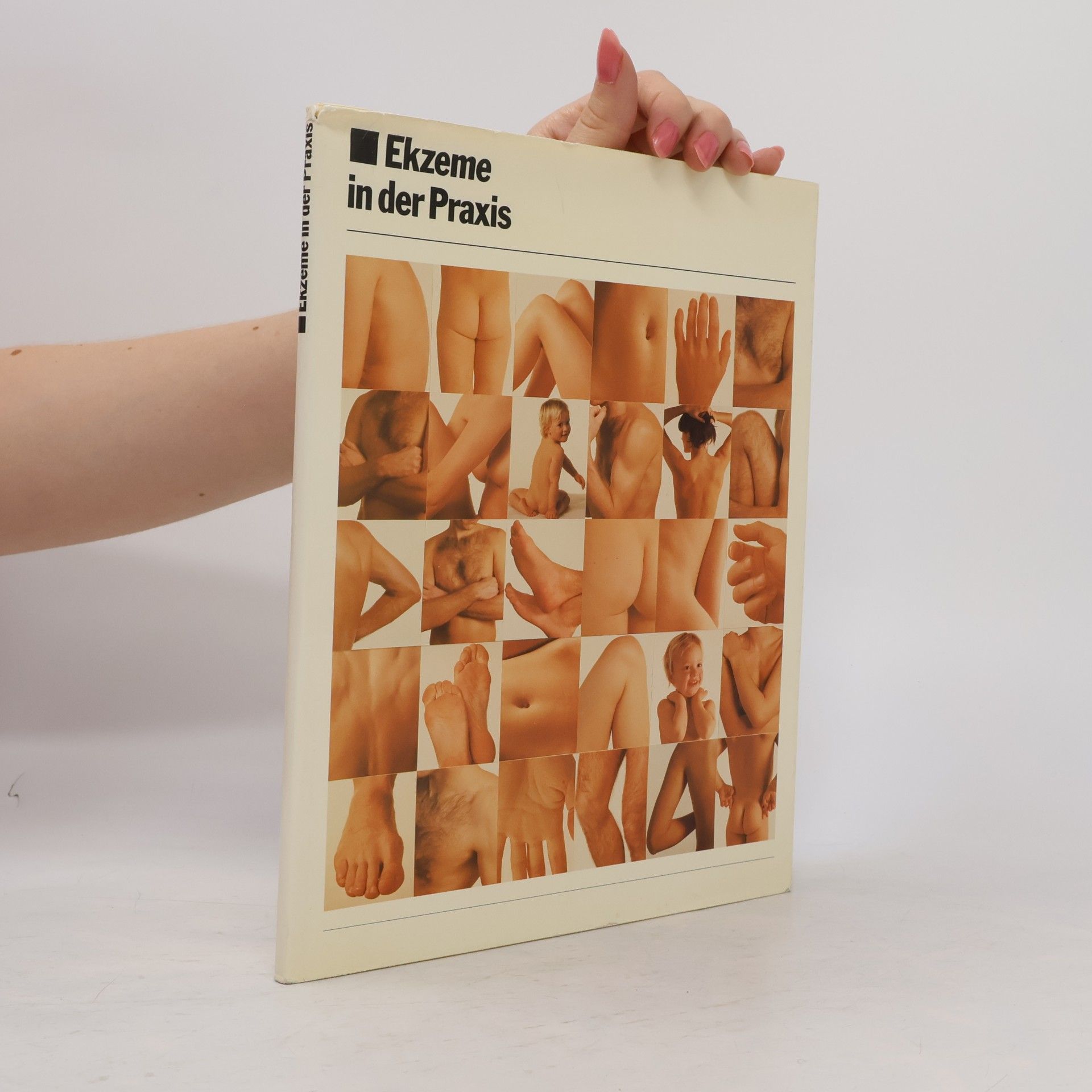 Autorenkollektiv Ekzeme in der Praxis