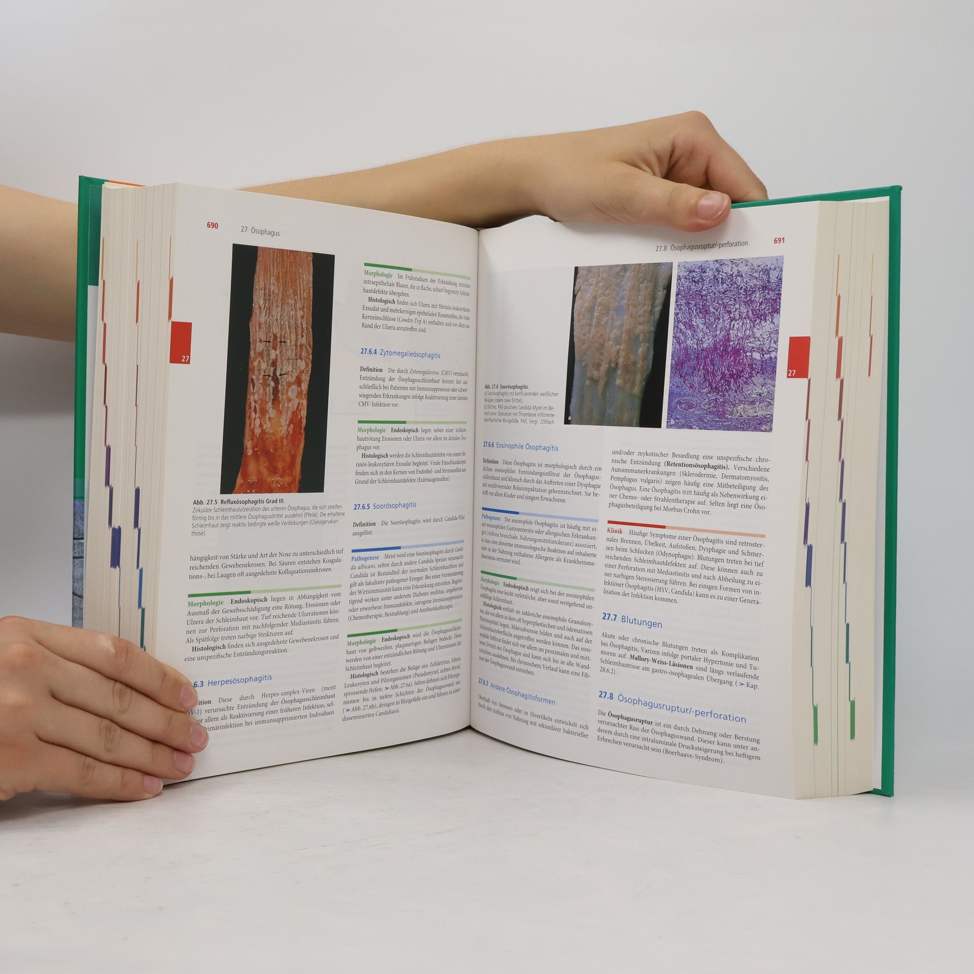 Holger Moch Pathologie - 4. Auflage