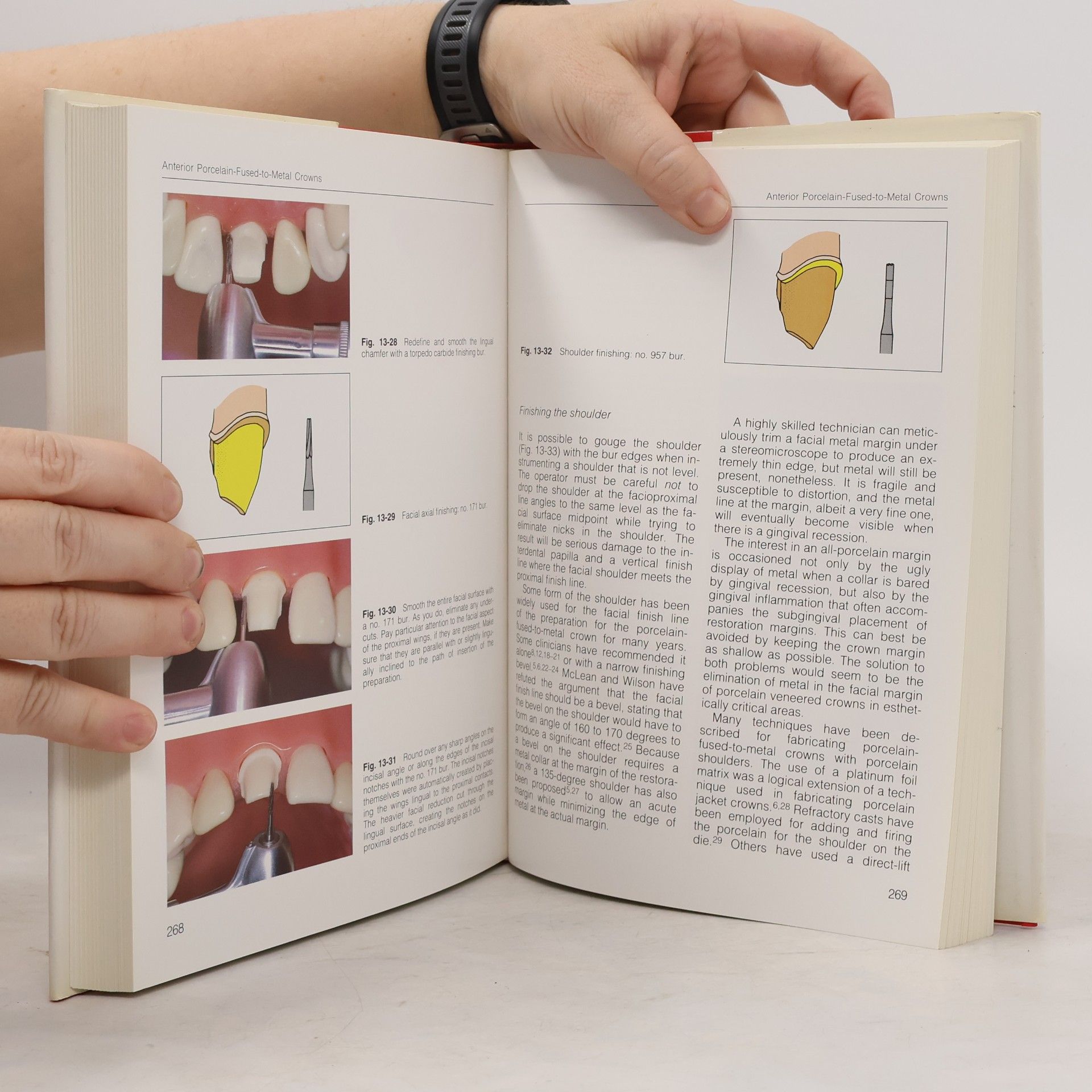 Herbert T. Shillingburg Jr. Fundamentals of Tooth Preparations for Cast Metal and Porcelain Restorations