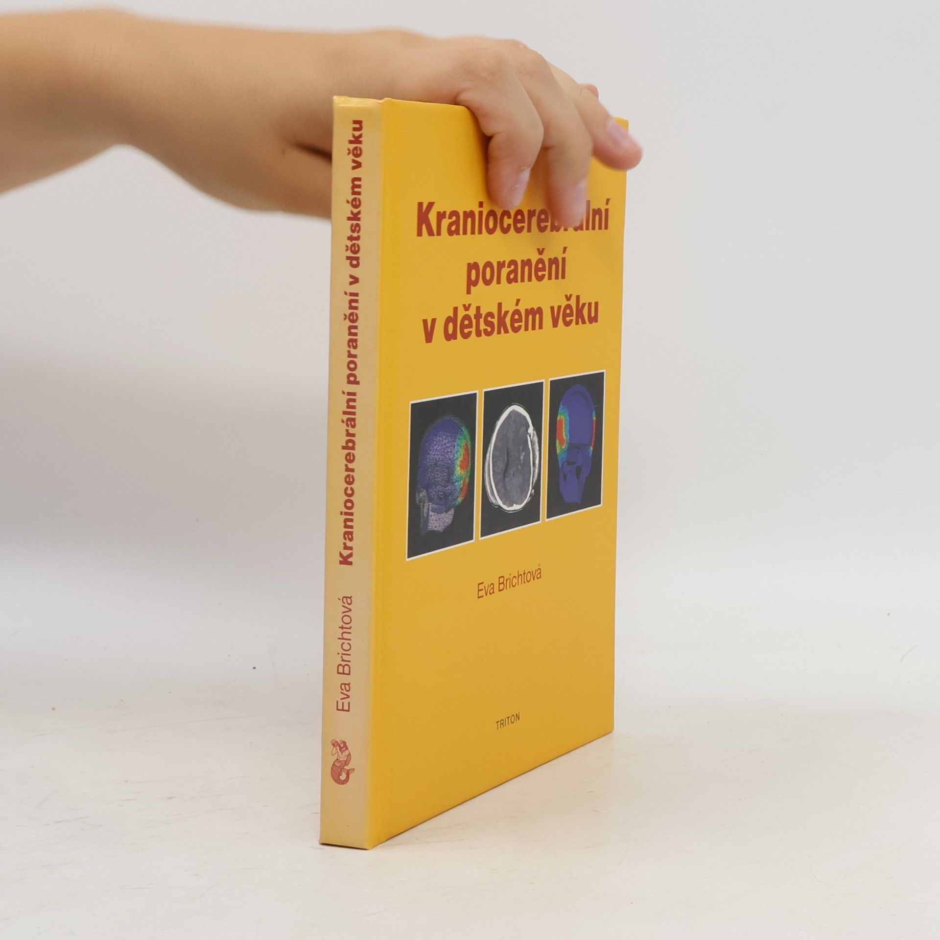 Eva Brichtová Kraniocerebrální poranění v dětském věku