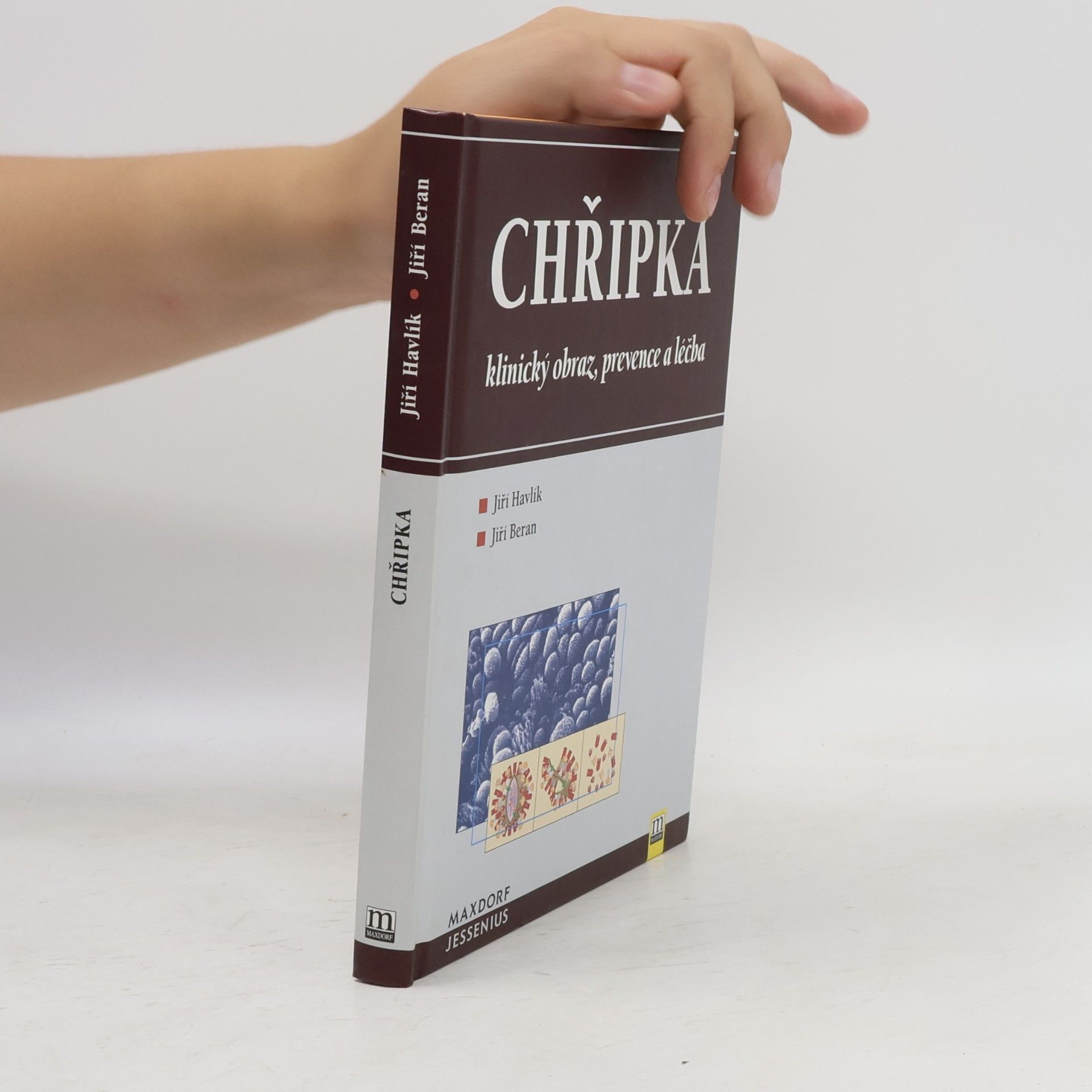 Chřipka - klinický obraz, prevence a léčba