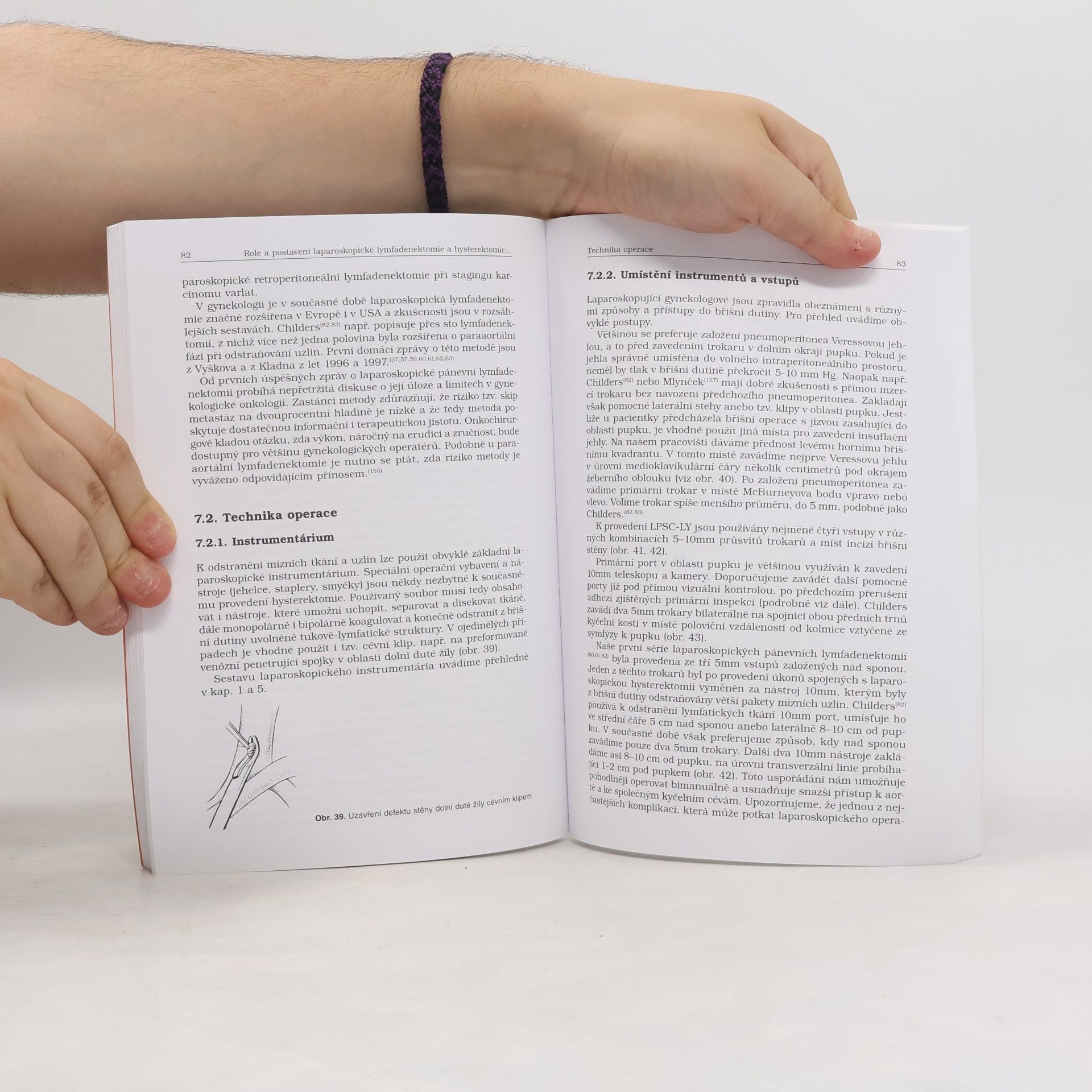 Zdeněk Holub Úloha laparoskopické hysterektomie v chirurgické léčbě chorob ženského reprodukčního systému