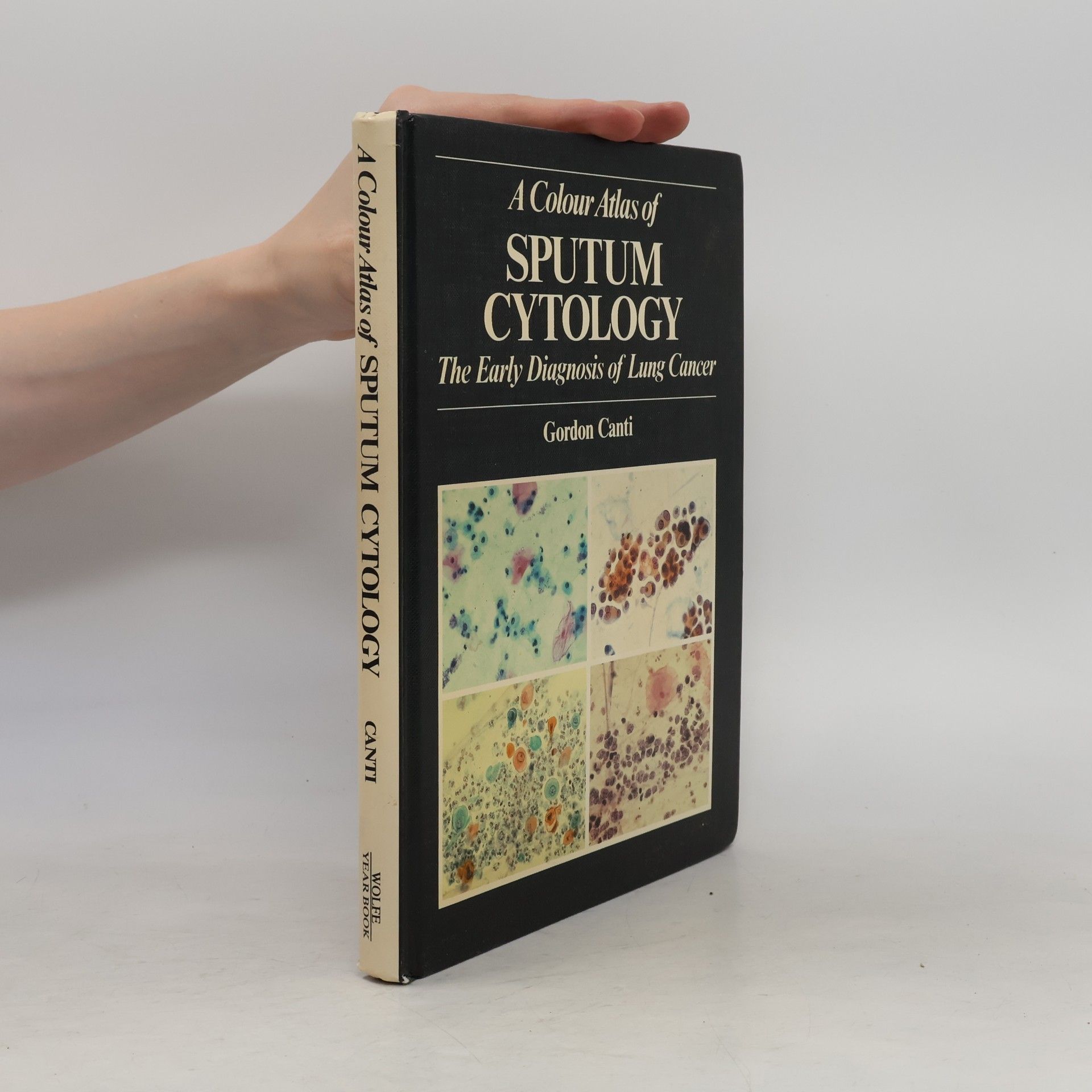 Gordon Canti A Colour Atlas of Sputum Cytology