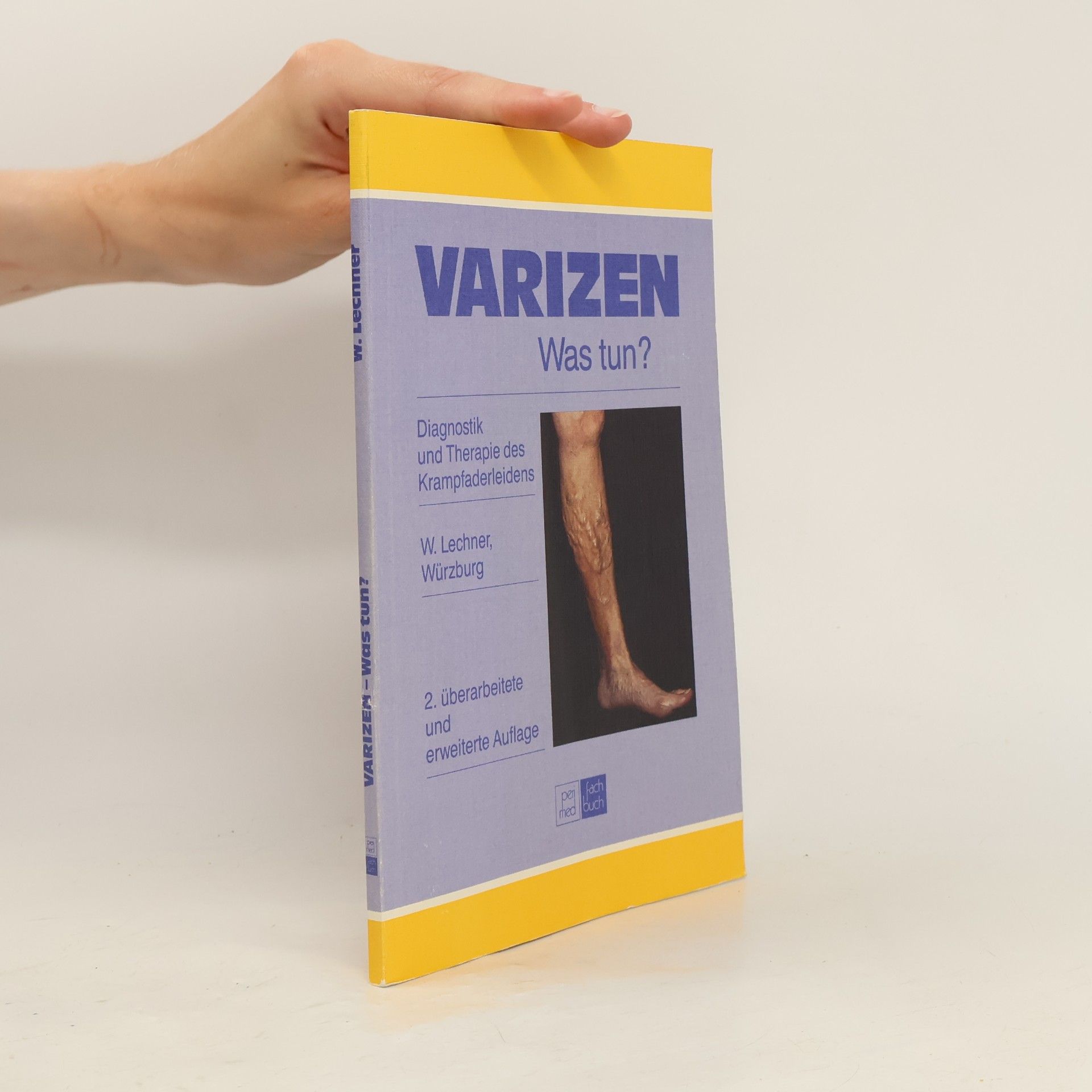 Walter Lechner Varizen - Was tun?