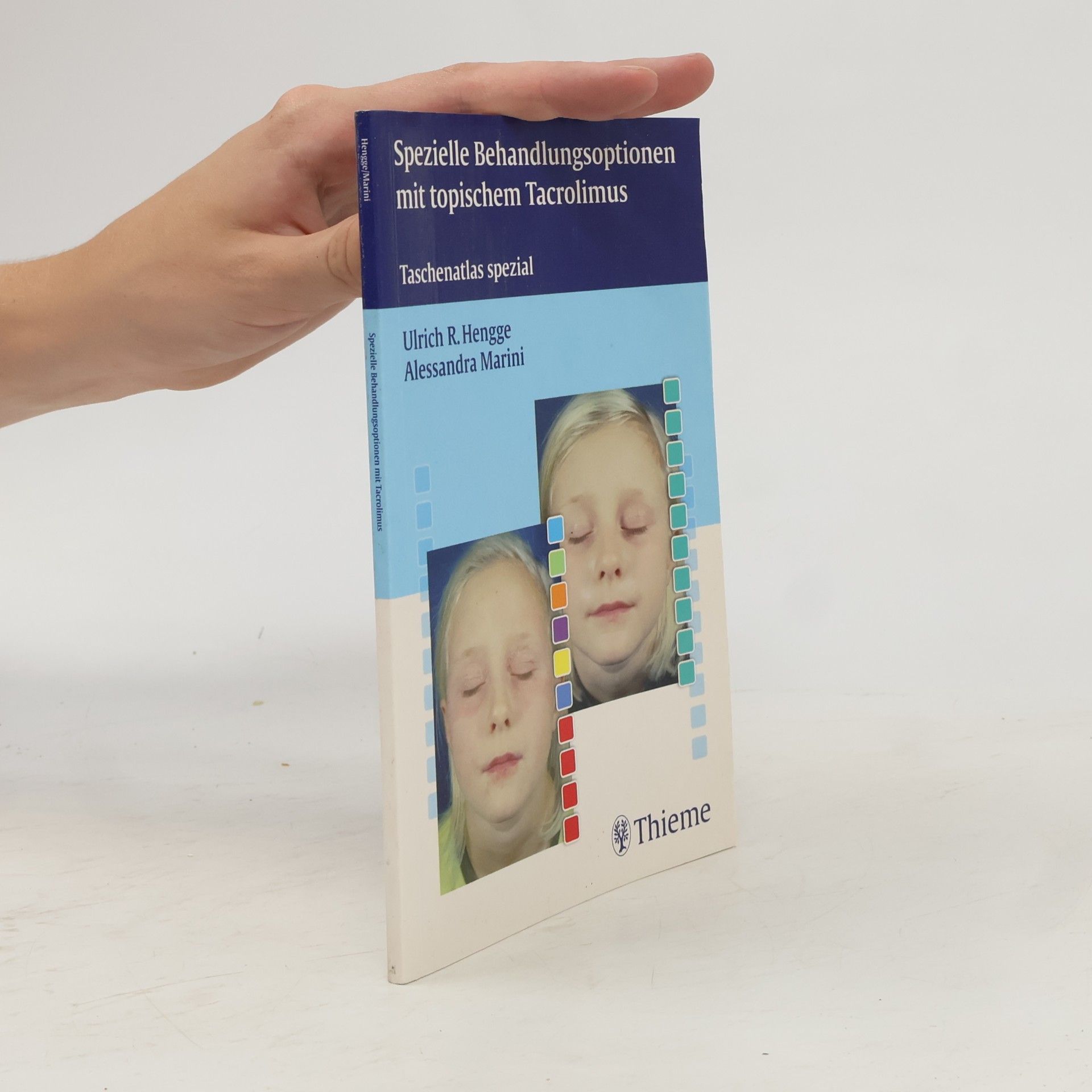 Alessandra Marini Spezielle Behandlungsoptionen mit topischem Tacrolimus: Taschenatlas spezial