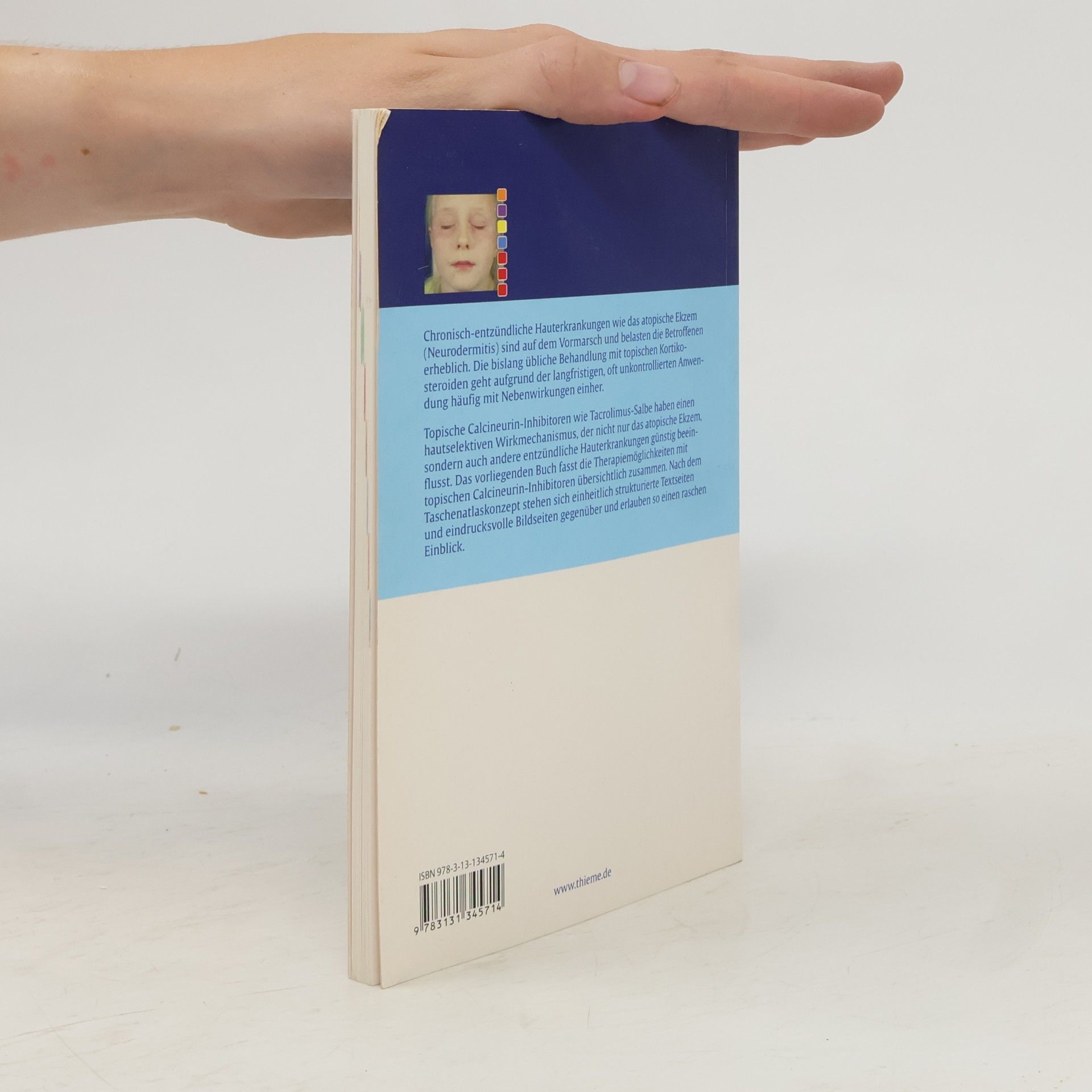 Ulrich R. Hengge Spezielle Behandlungsoptionen mit topischem Tacrolimus: Taschenatlas spezial