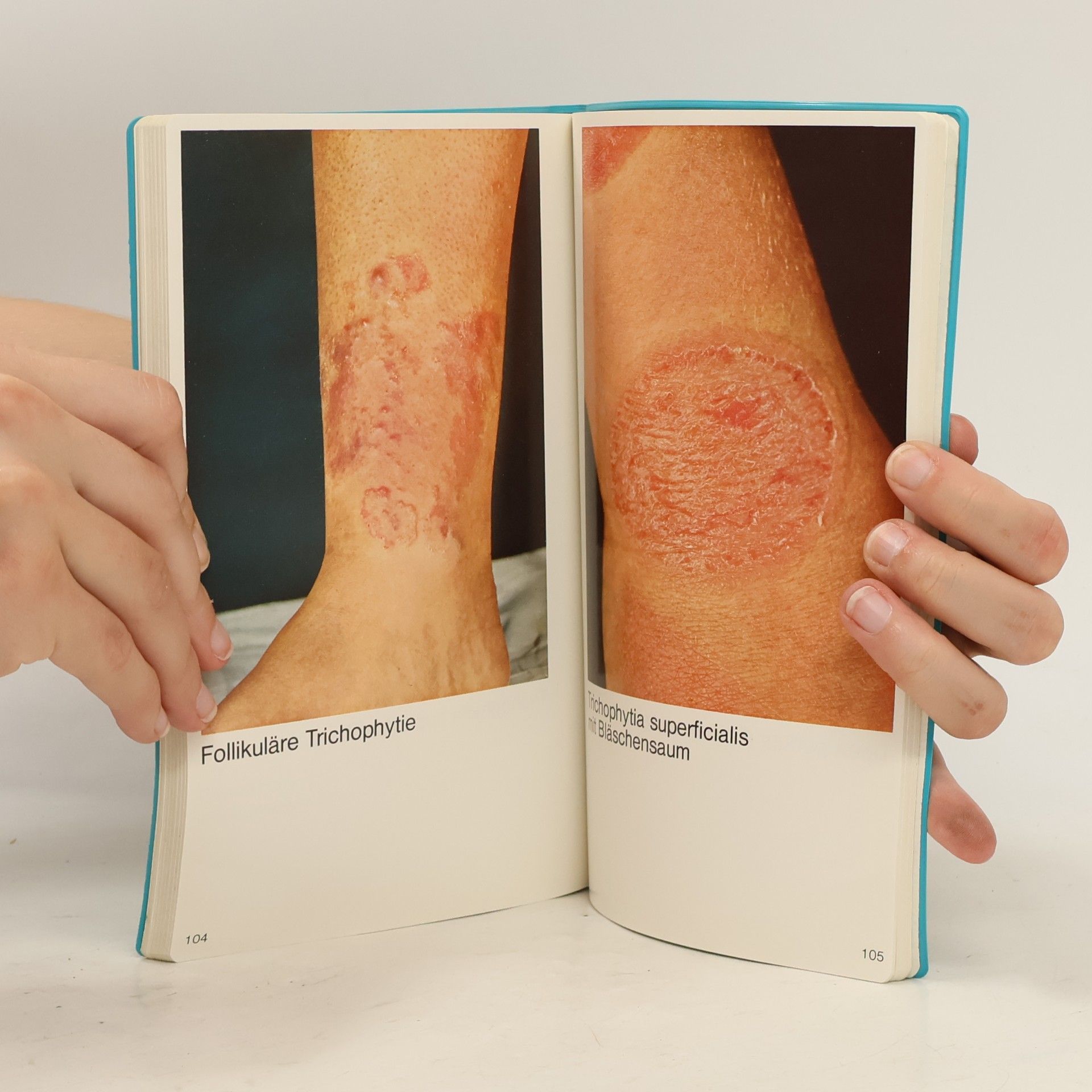 Bernward Rohde Hamburg Dermatologie in Stichworten