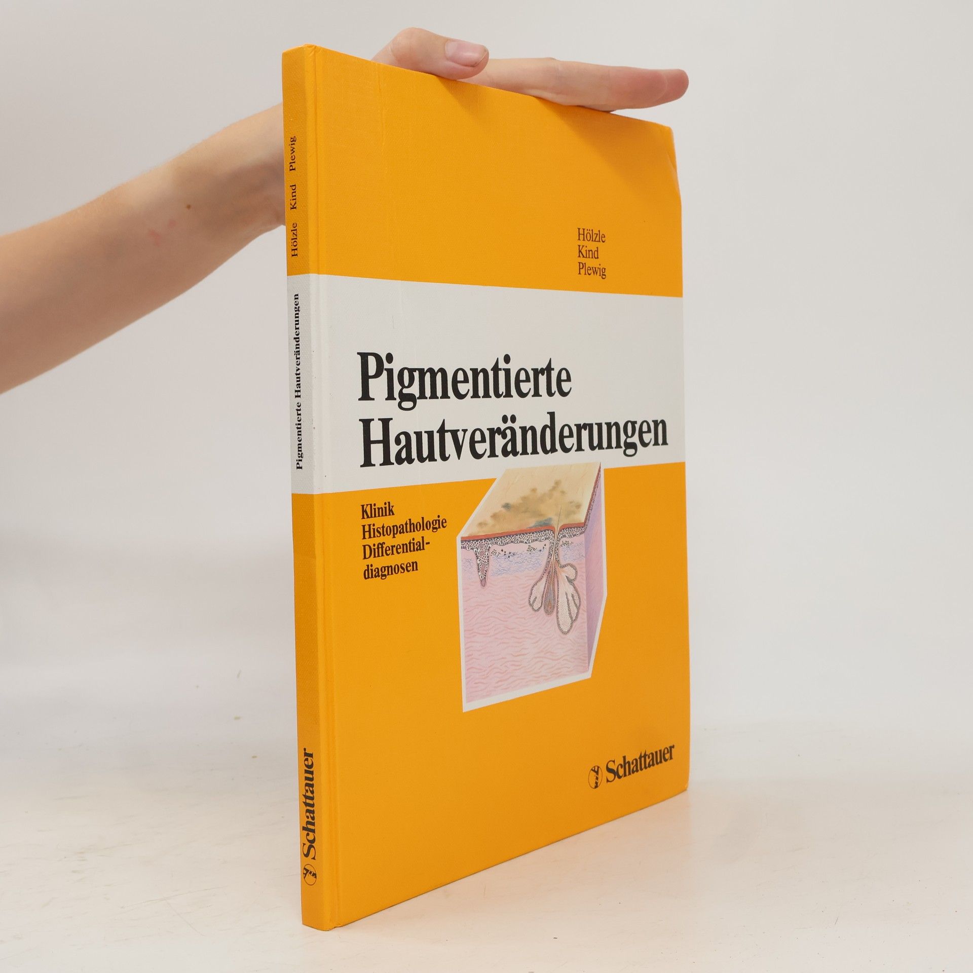 Peter Kind Pigmentierte Hautveränderungen