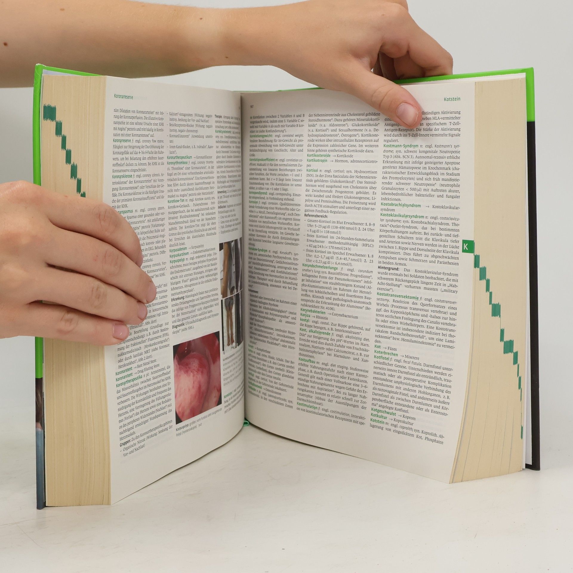 Autores varios Pschyrembel Klinisches Wörterbuch