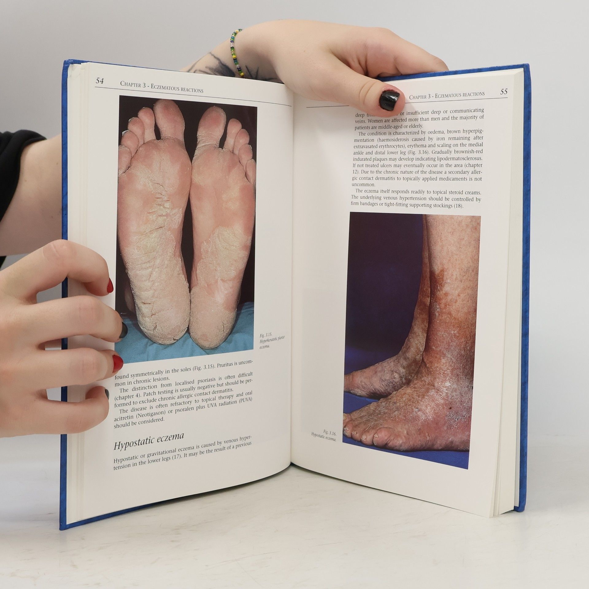Carsten Sand Petersen Colour Atlas of Pedal Dermatoses