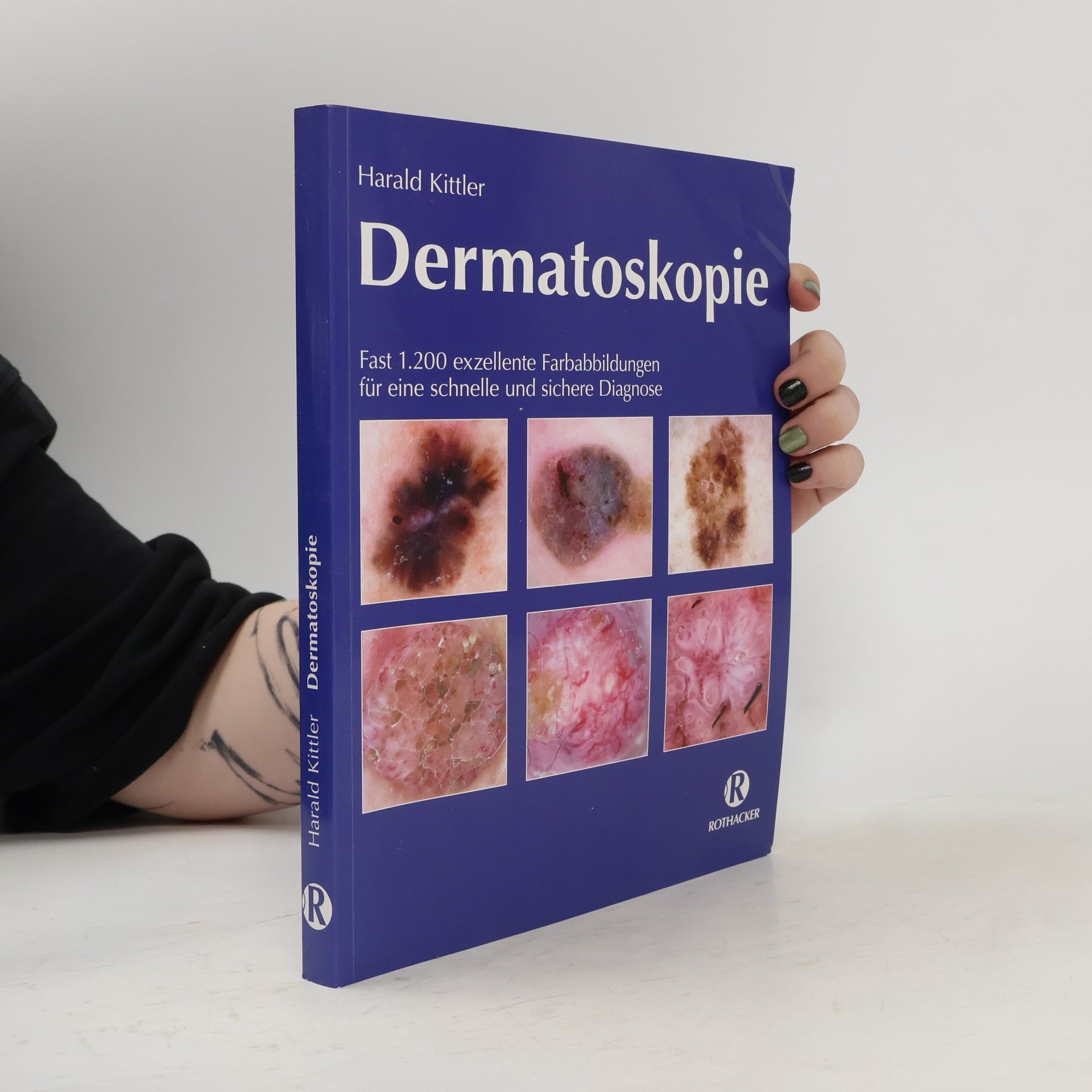 Harald Kittler Dermatoskopie