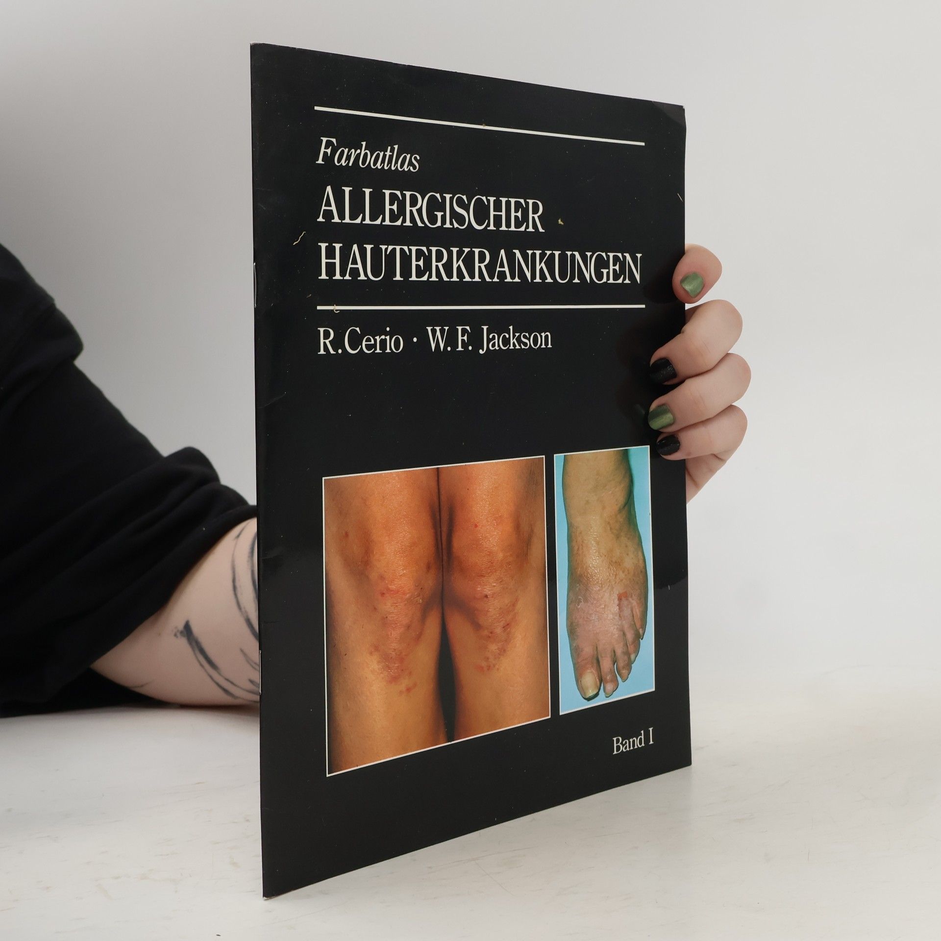 Farbatlas allergischer Hauterkrankungen. Band I