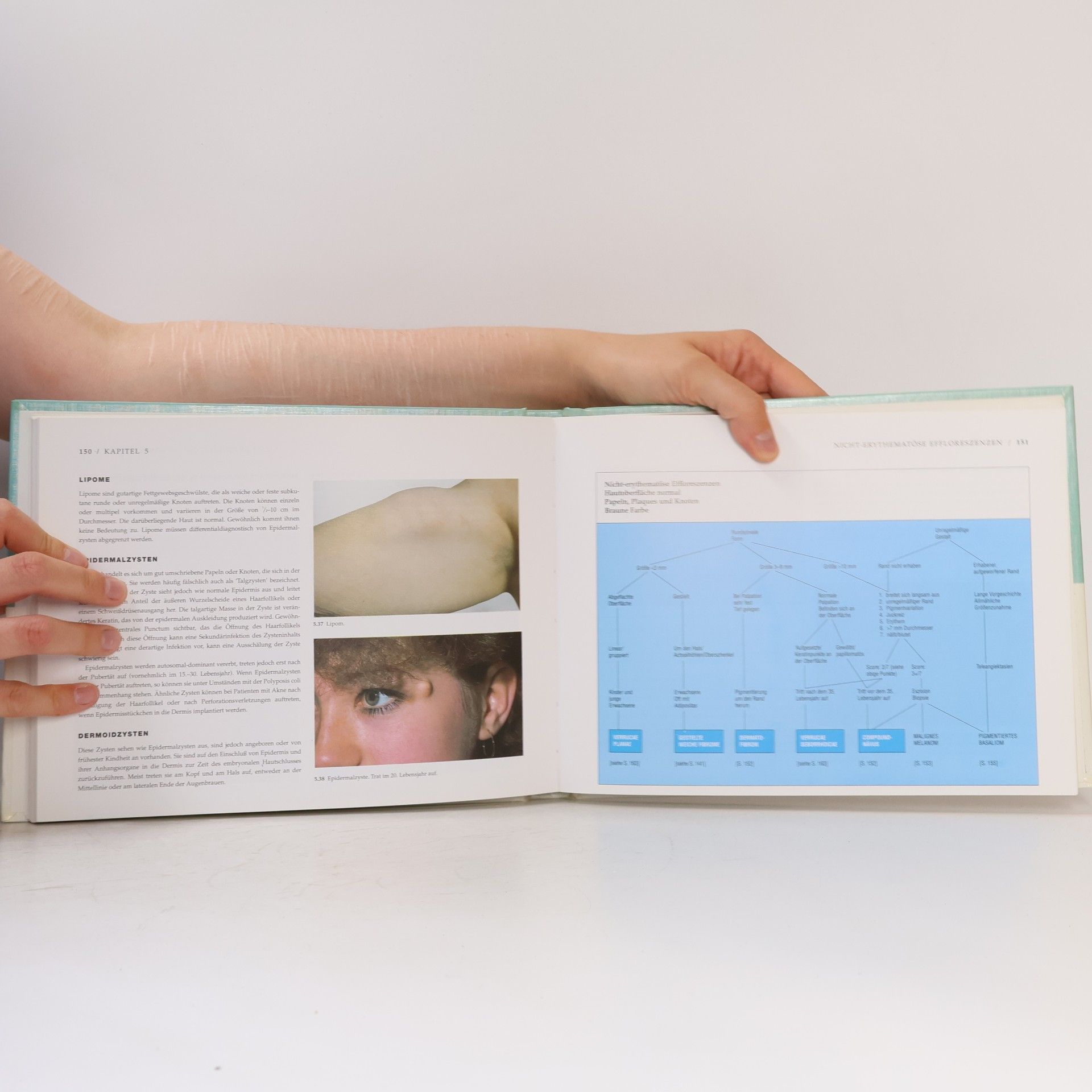 Richard Ashton Differential Diagnosis In Dermatology