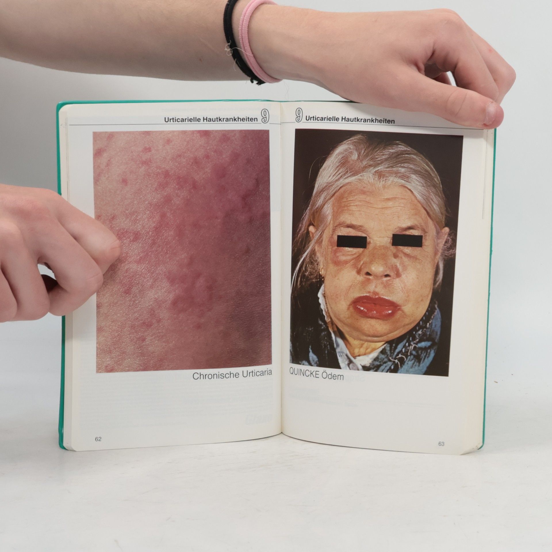 Bernward Rohde Hamburg Dermatologie in Stichworten