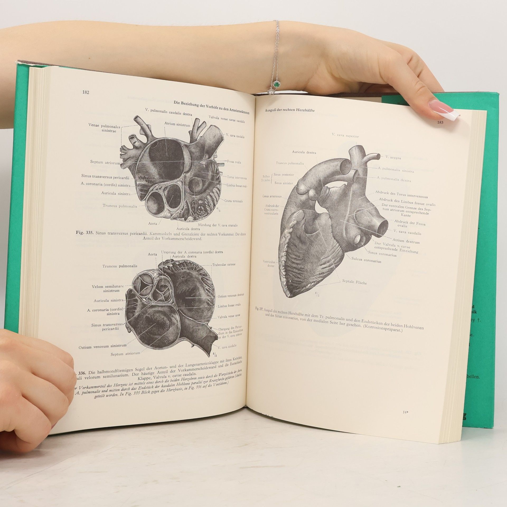Toldt Anatomischer Atlas 2
