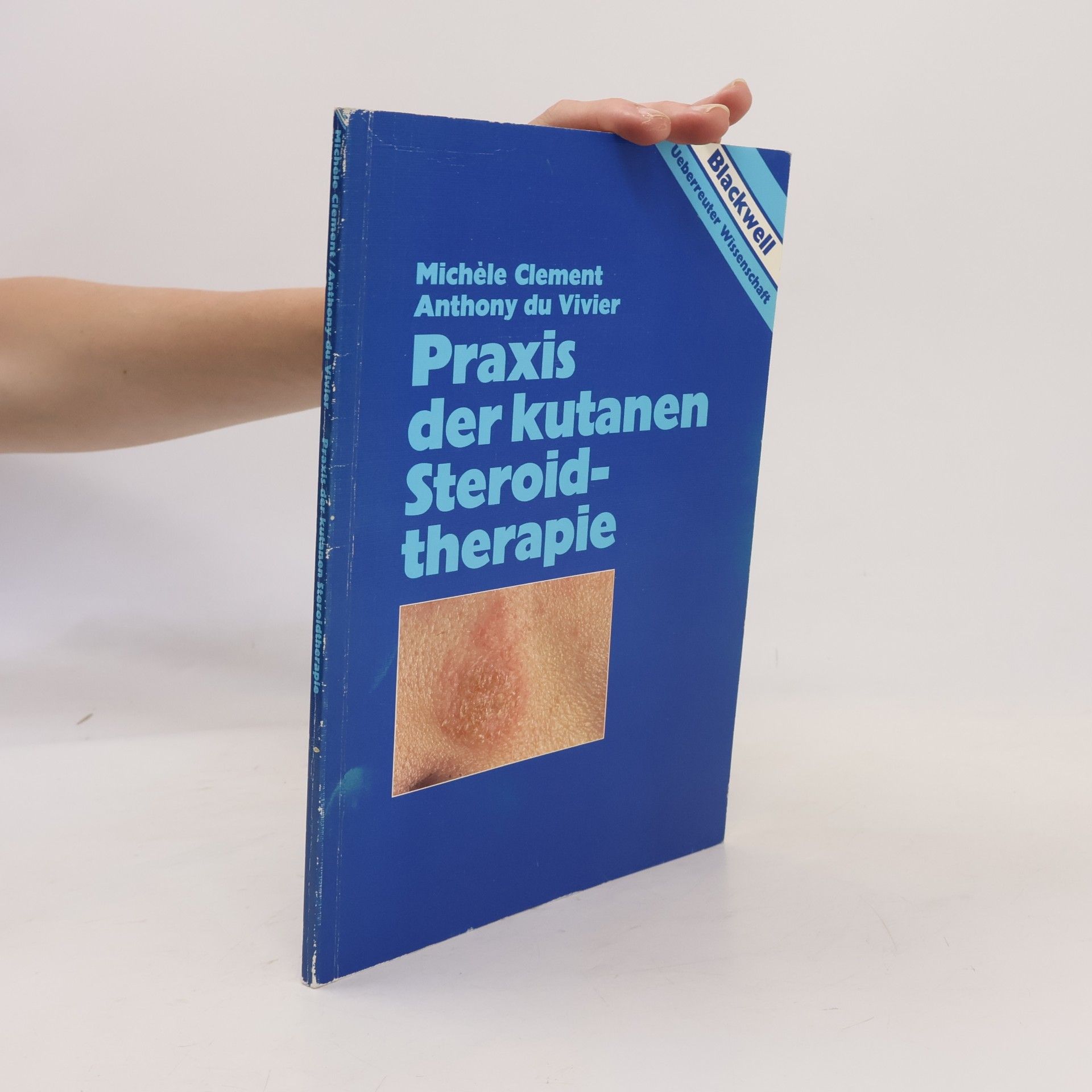 Michèle Clément Praxis der kutanen Steroidtherapie