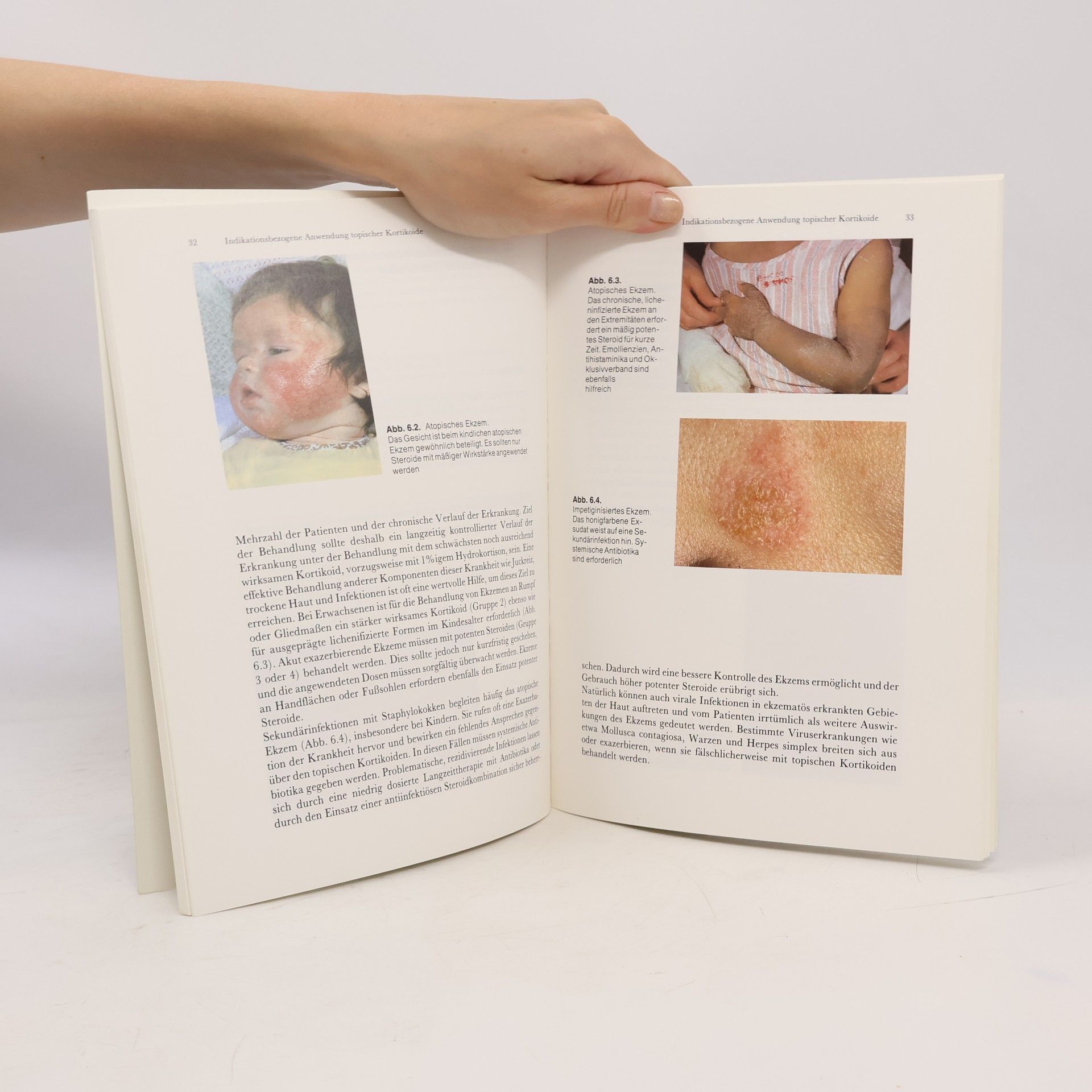 Michèle Clément Praxis der kutanen Steroidtherapie