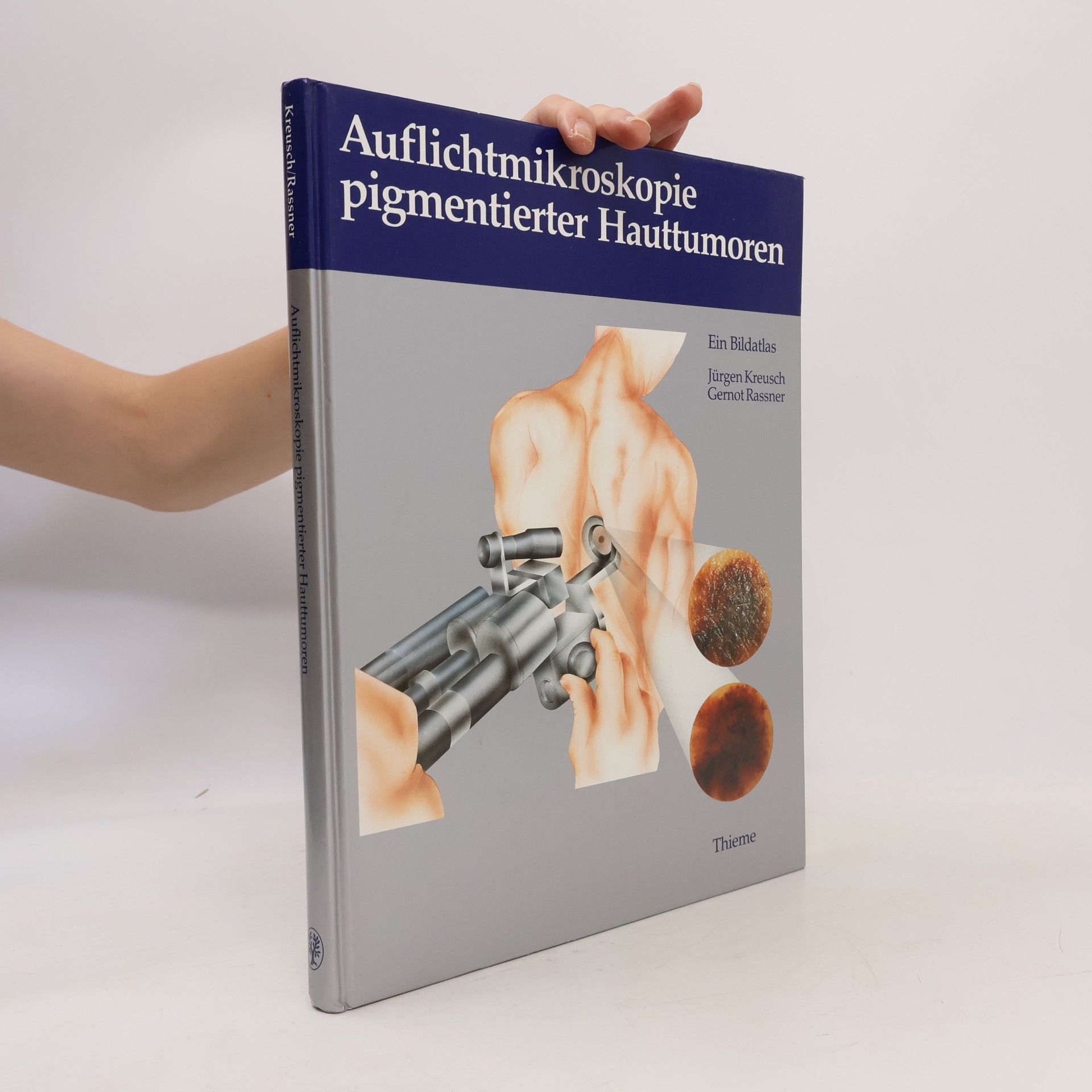 Jürgen Kreusch Auflichtmikroskopie pigmentierter Hauttumoren
