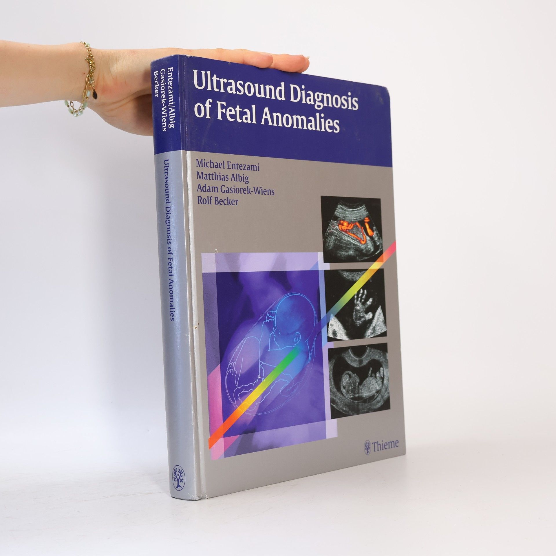 Adam Gasiorek-Wiens Ultrasound Diagnosis of Fetal Anomalies