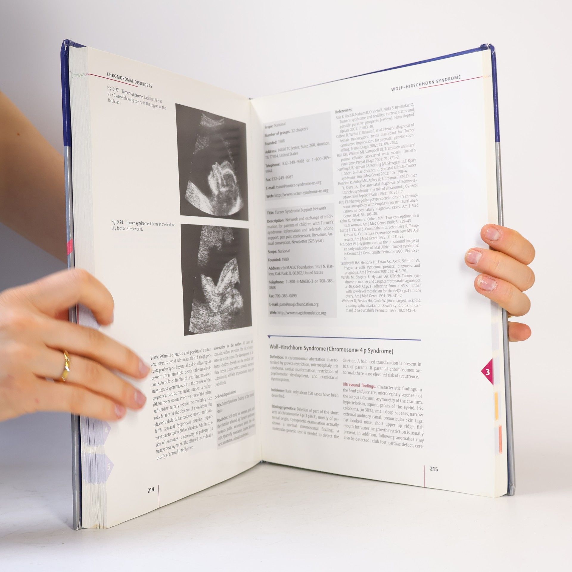 Michael Entezami Ultrasound Diagnosis of Fetal Anomalies