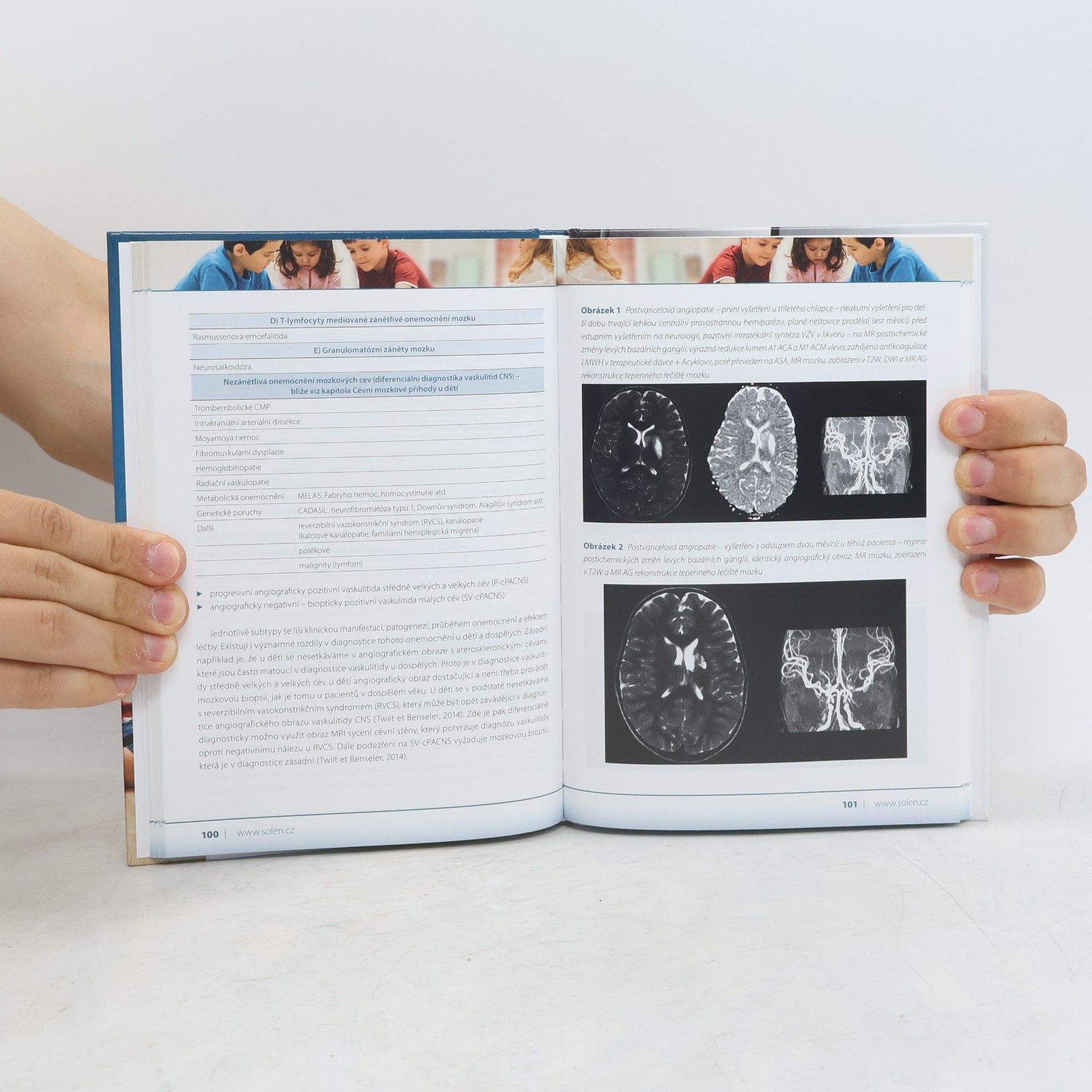 Hana Ošlejšková Aktuální kapitoly z dětské neurologie pro praxi