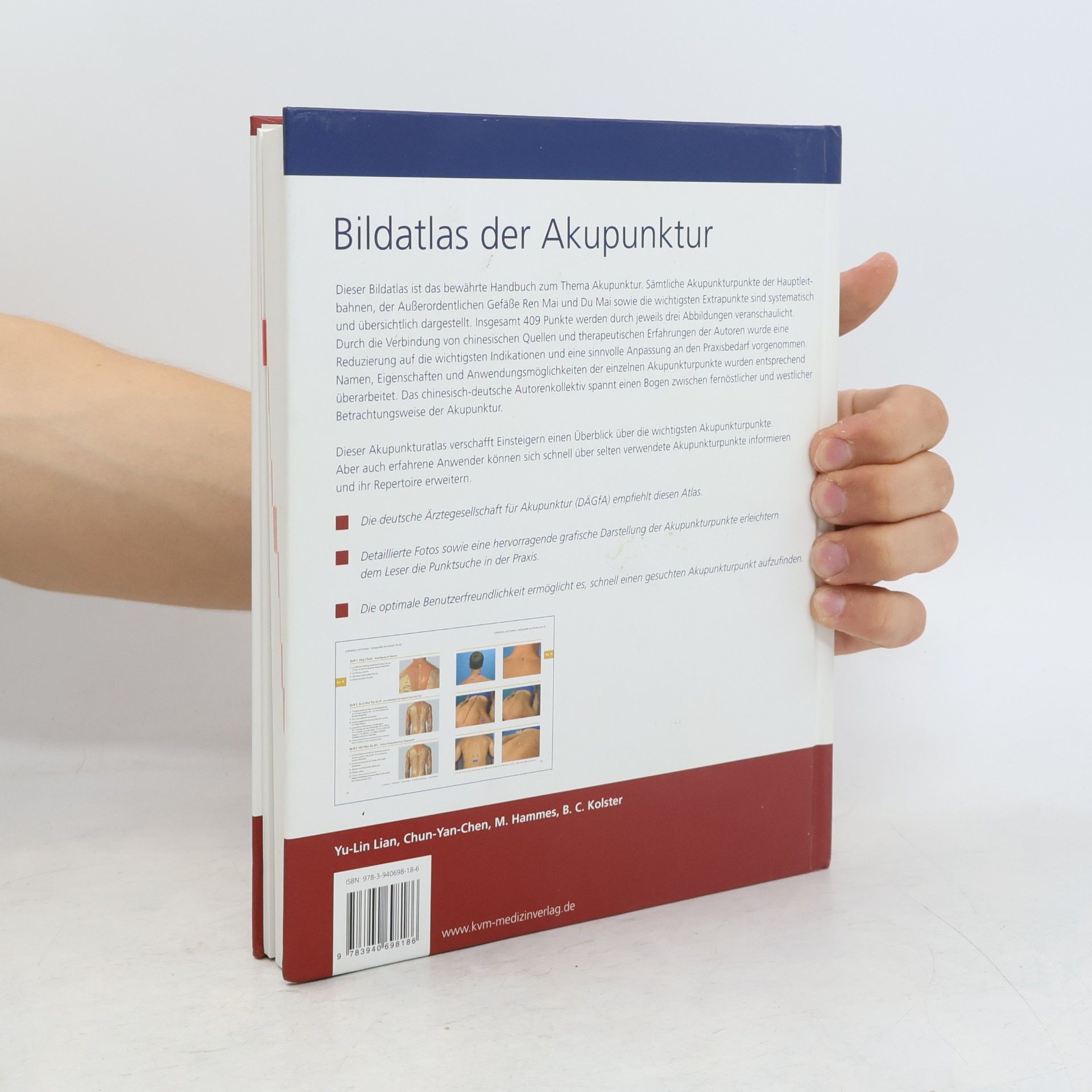 Yu-Lin Lian Bildatlas der Akupunktur