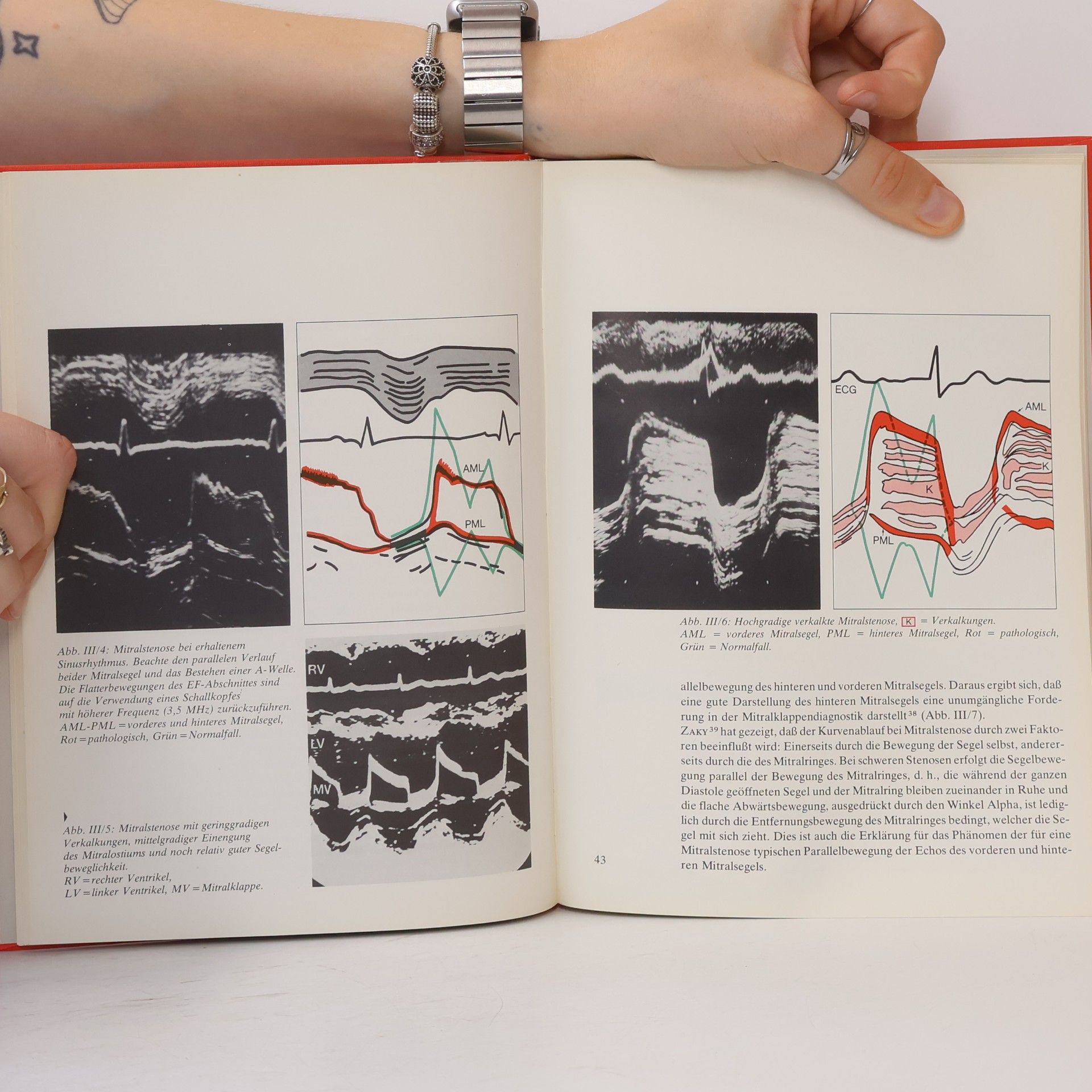 G. Stefan Kardiologische Diagnostik. Echokardiographie