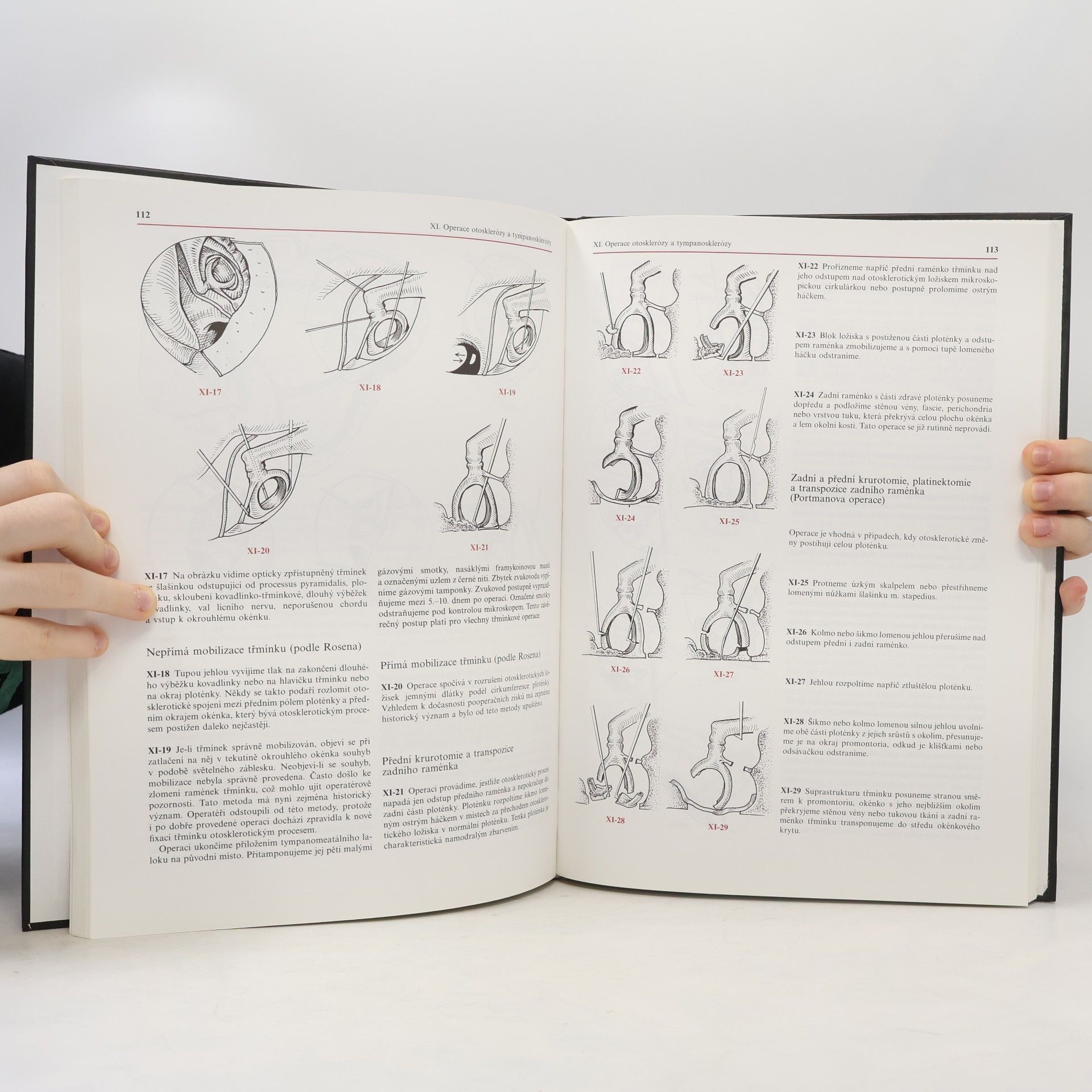 Ervín Černý Atlas chirurgie ucha