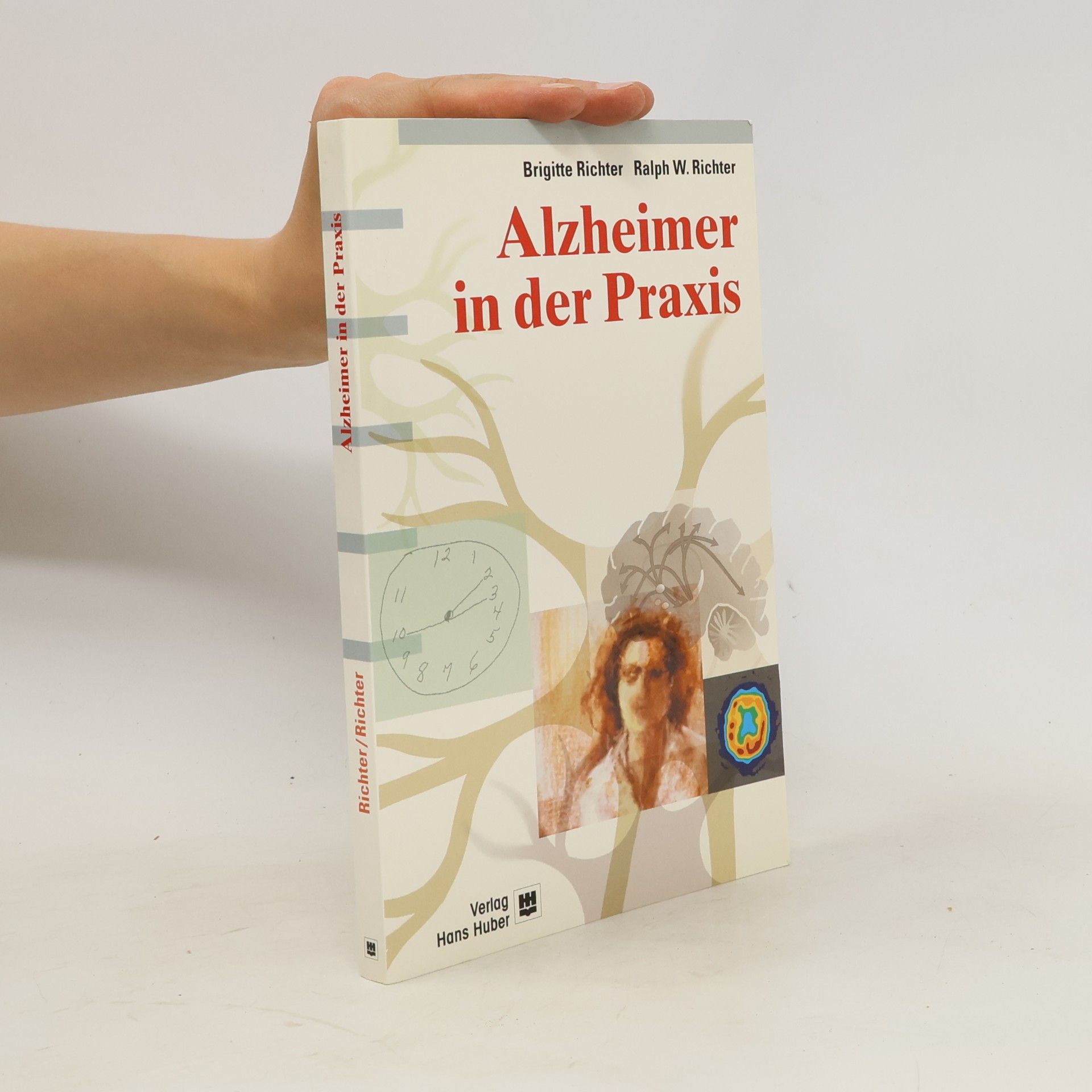 Alzheimer in der Praxis