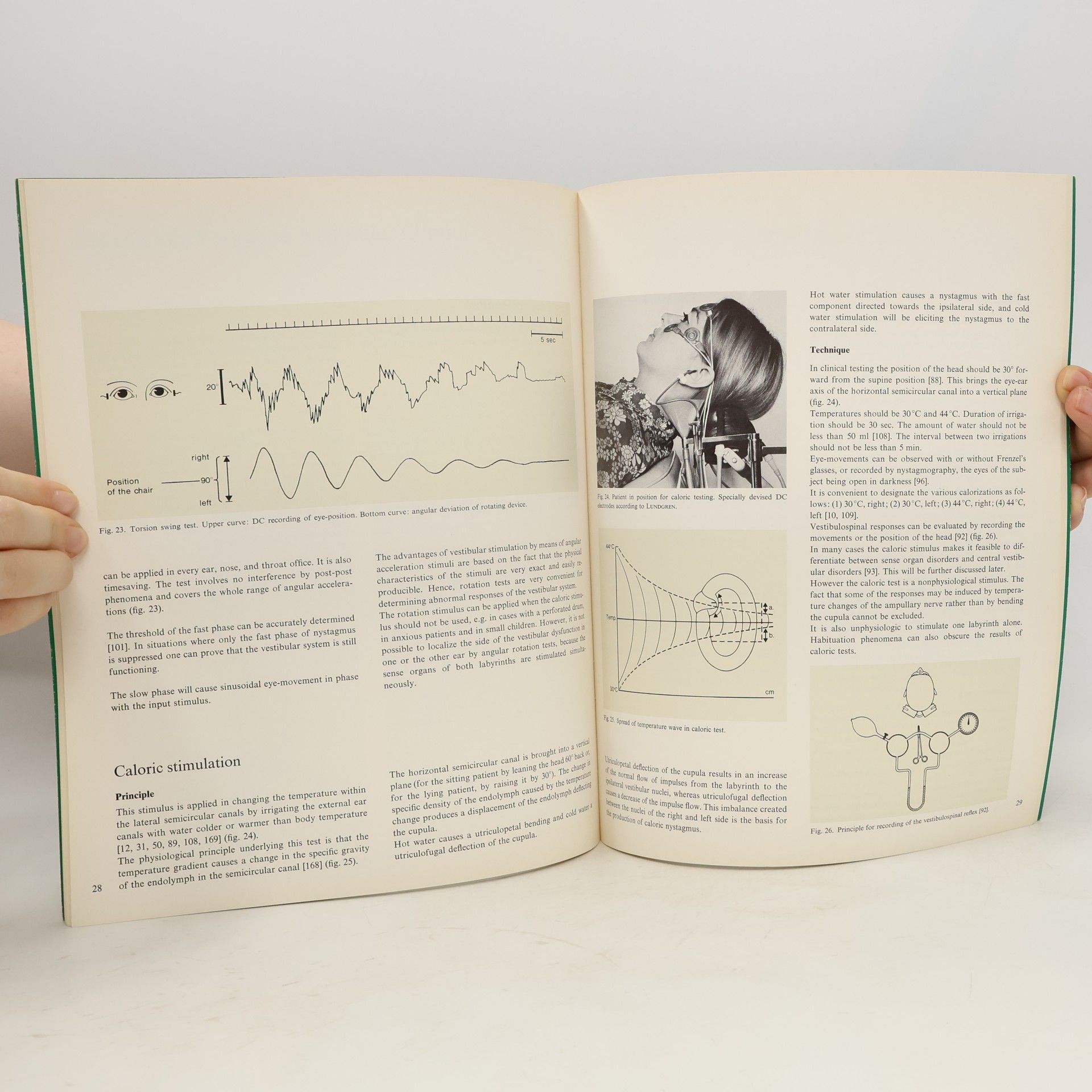 Kolektiv autorů A Synopsis of the Vestibular System