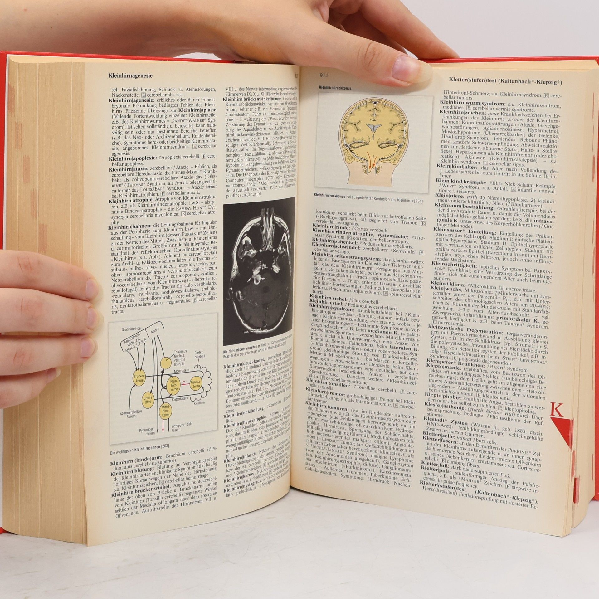 Collectif d'auteurs roche lexikon medizin